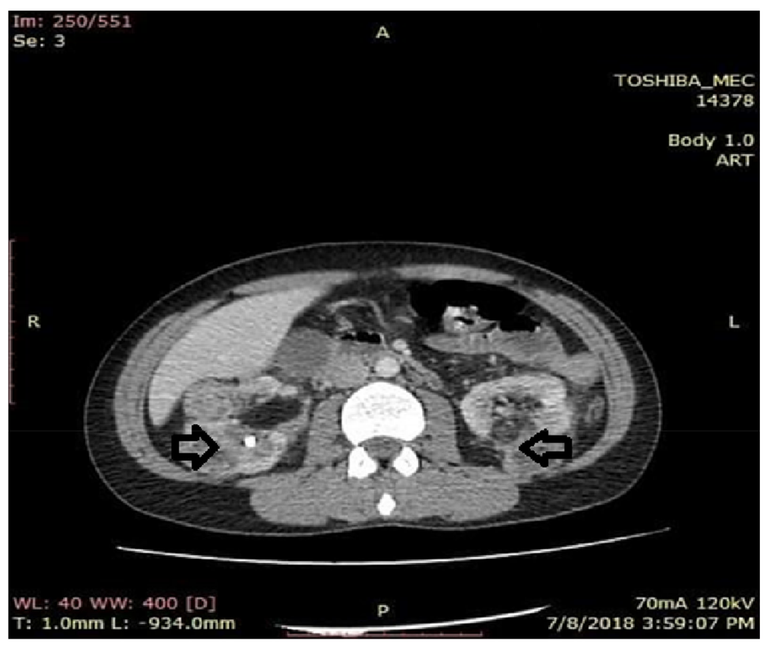 Medicina 56 00369 g005