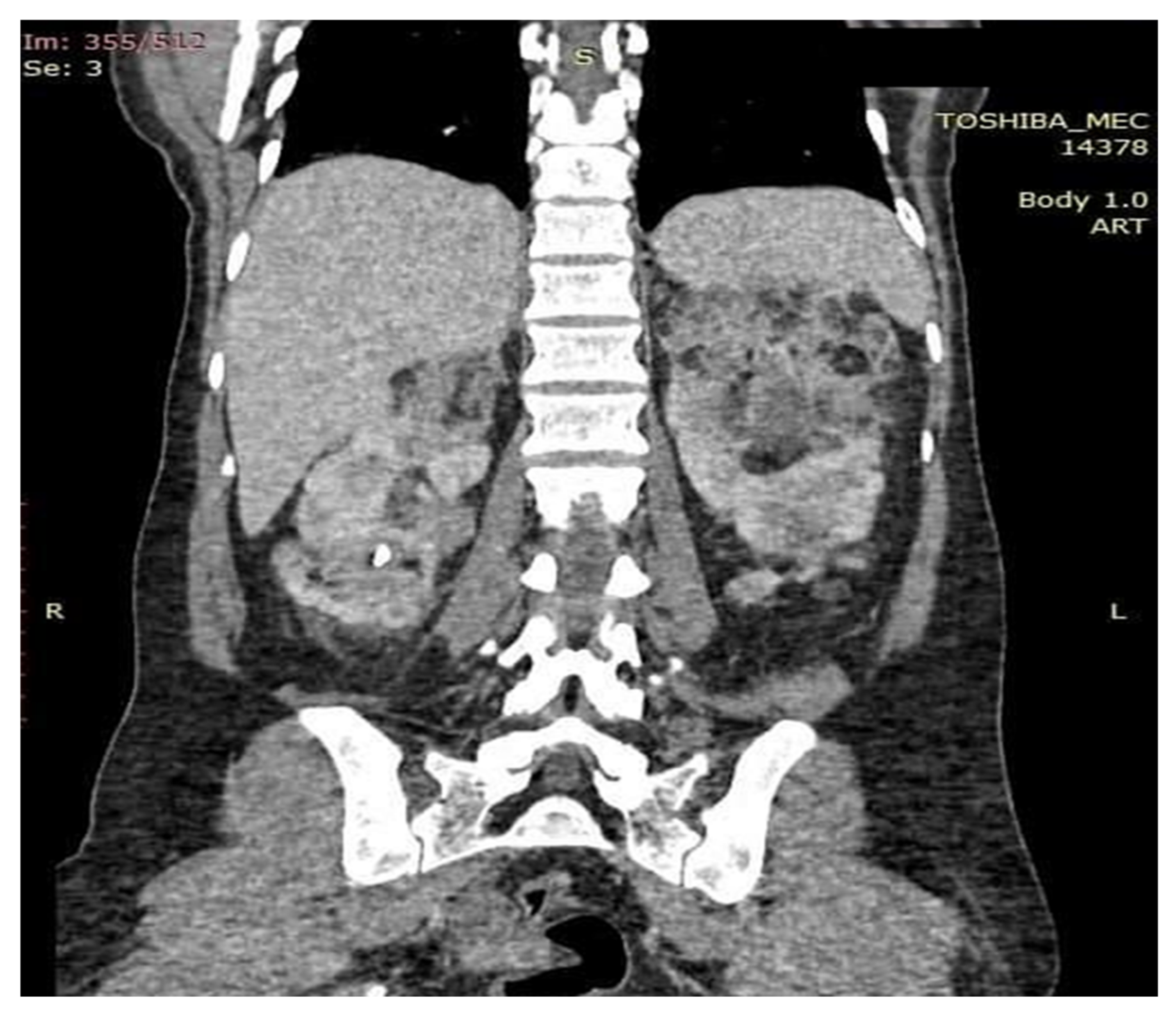 Medicina 56 00369 g006