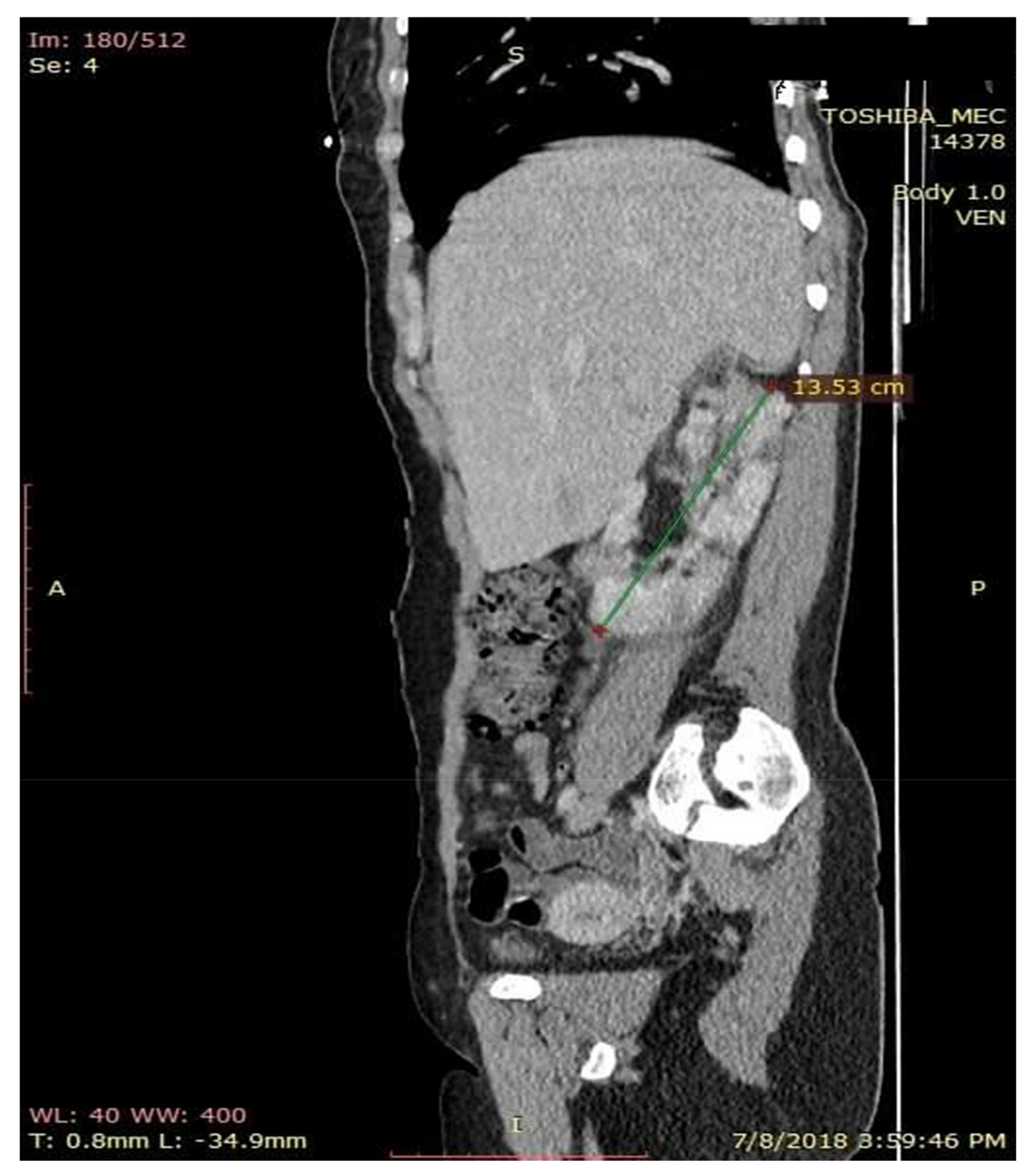 Medicina 56 00369 g007