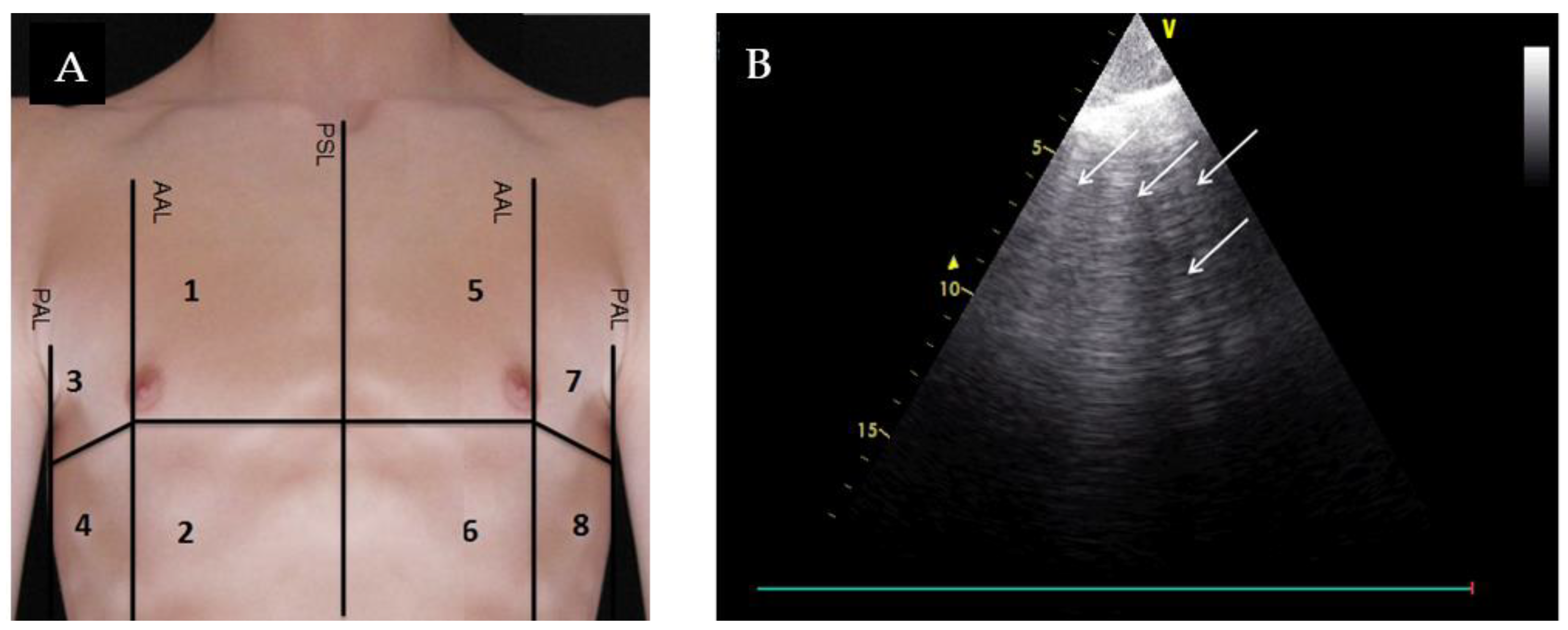 Medicina 56 00379 g001