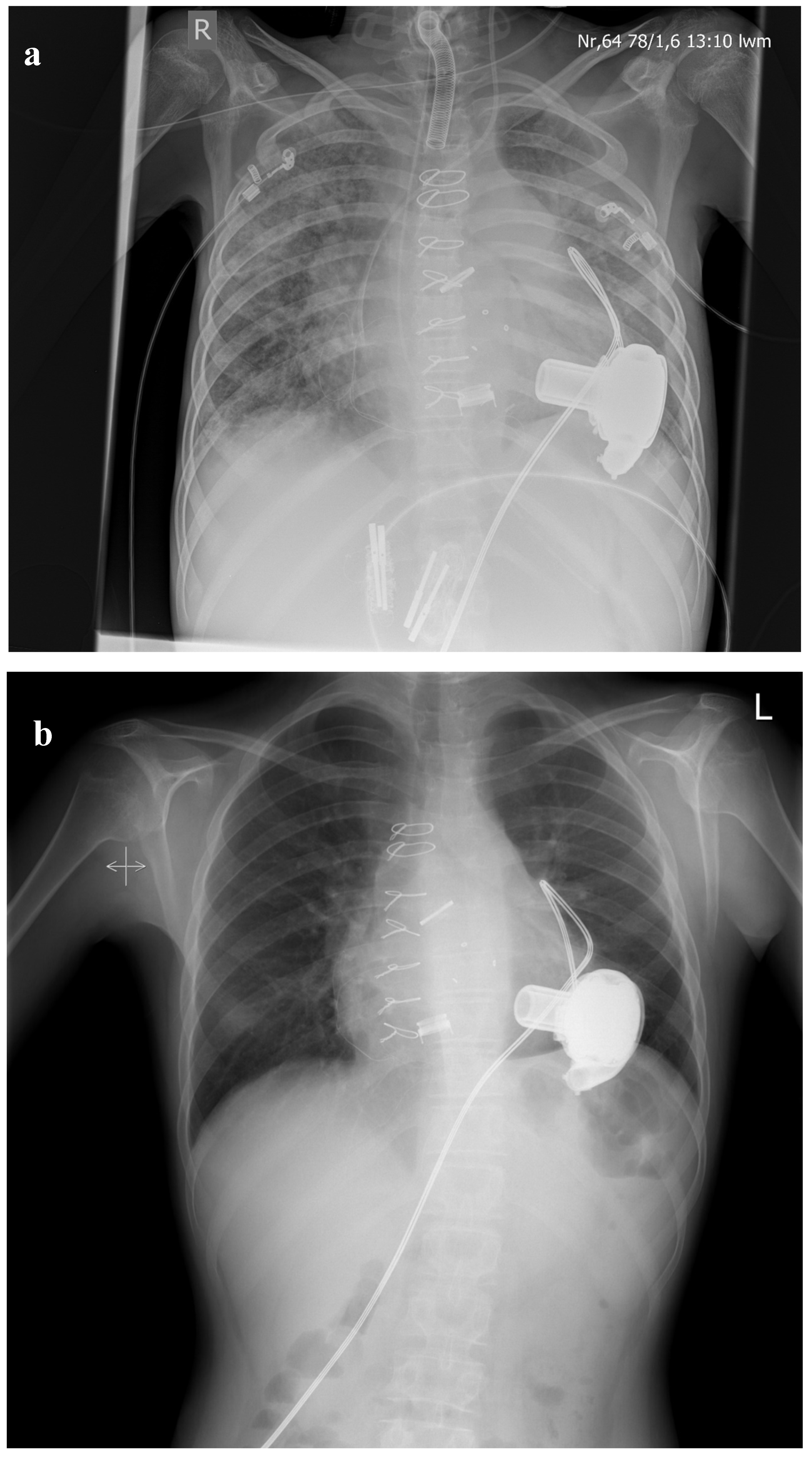 Medicina 56 00420 g001 Medicina 56 00420 g001