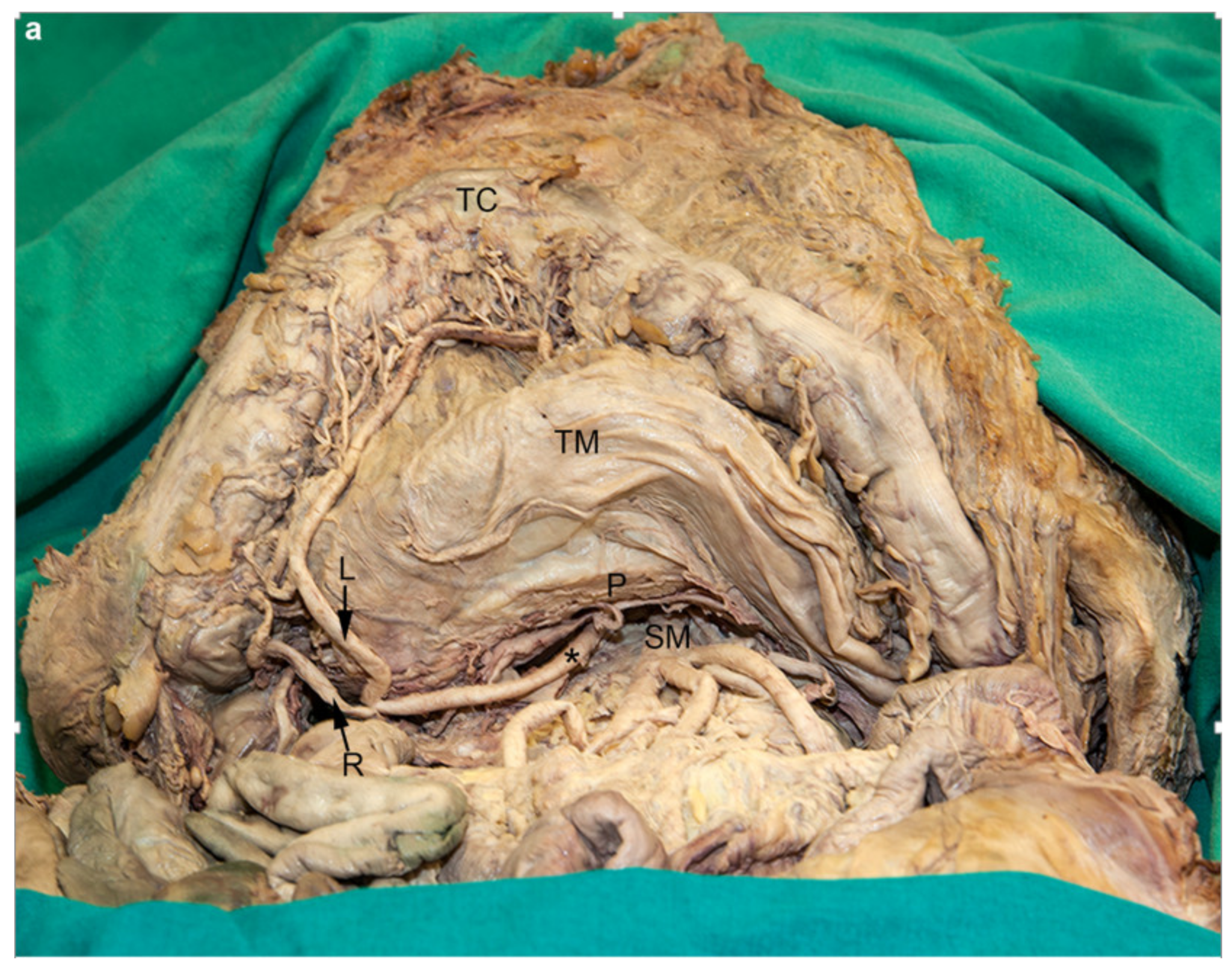 Medicina 56 00449 g001a