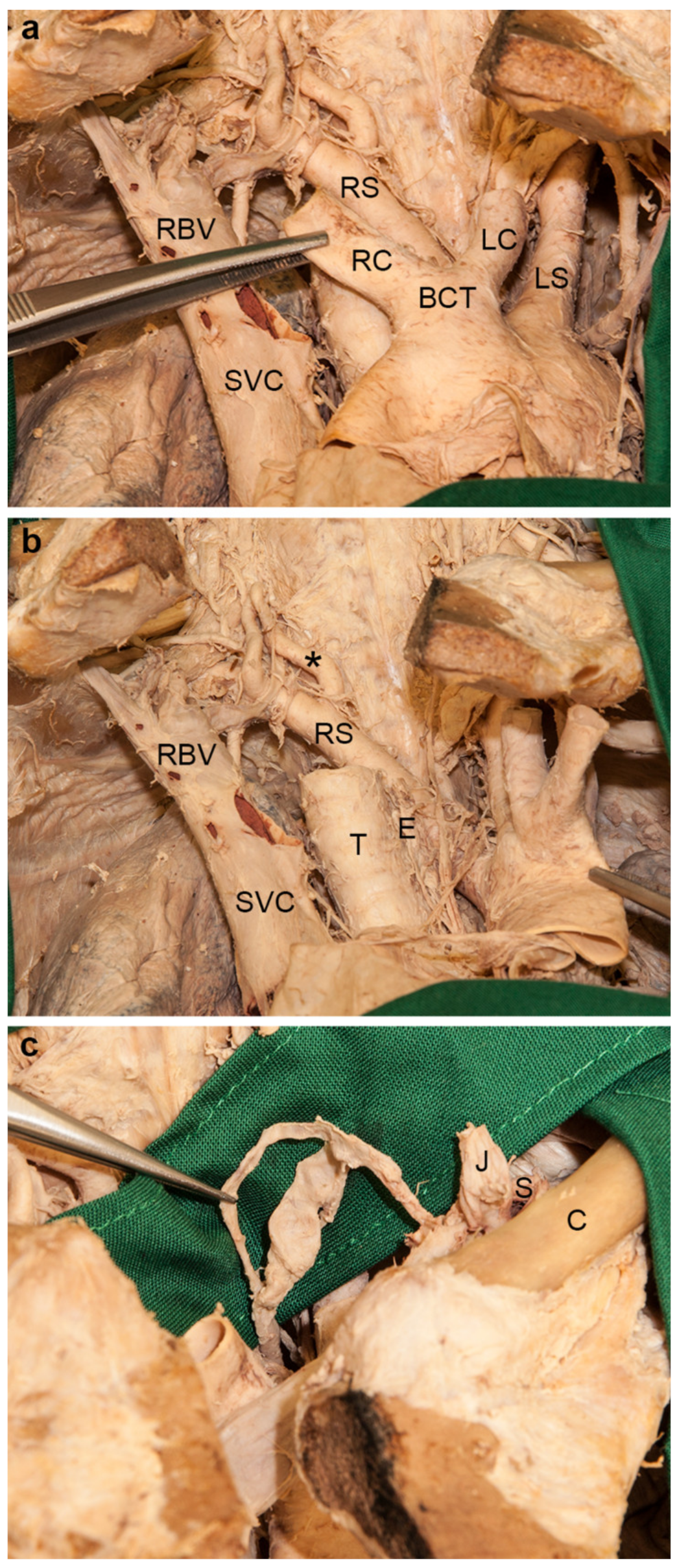 Medicina 56 00449 g004