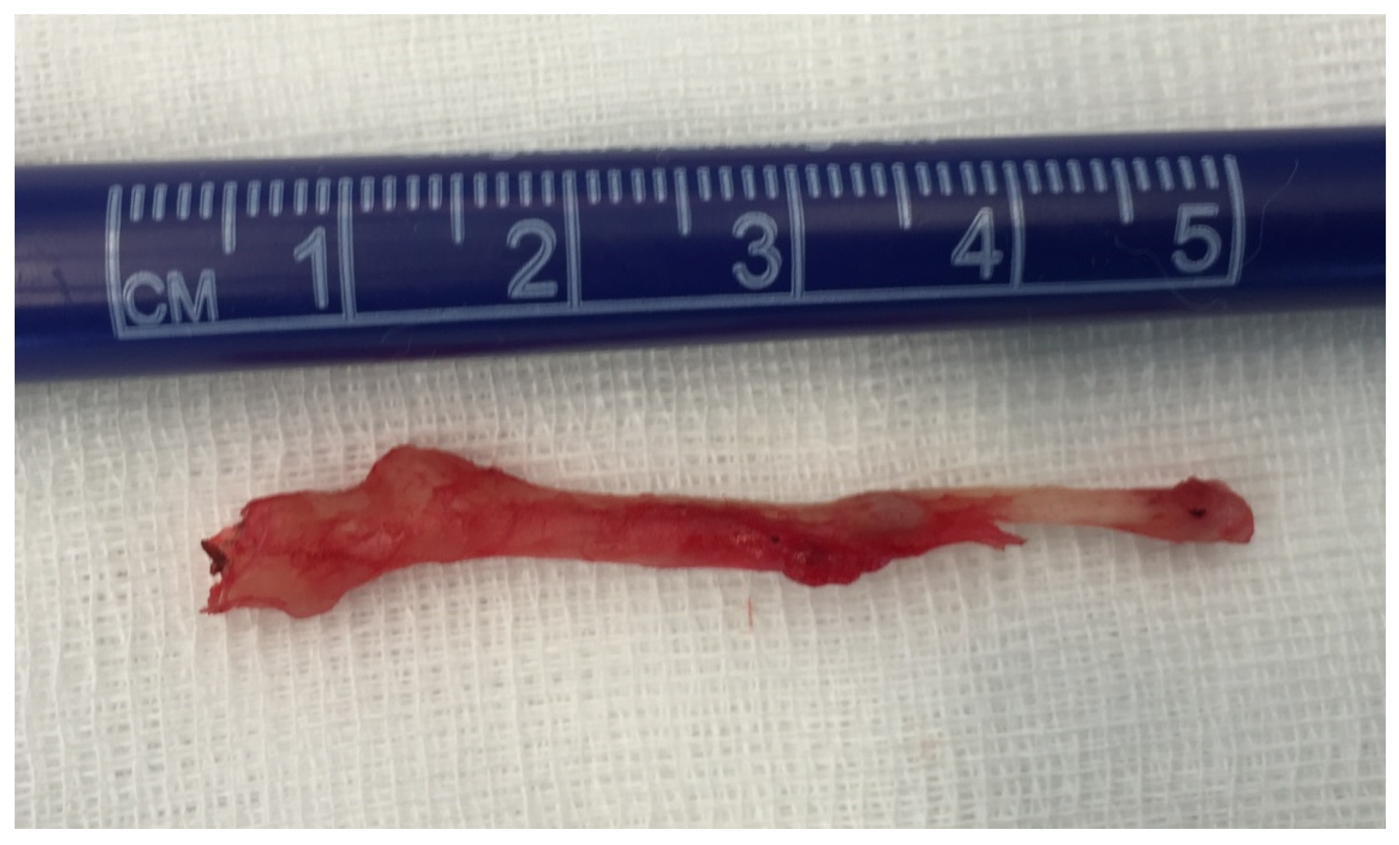 Medicina 56 00458 g005 Medicina 56 00458 g005