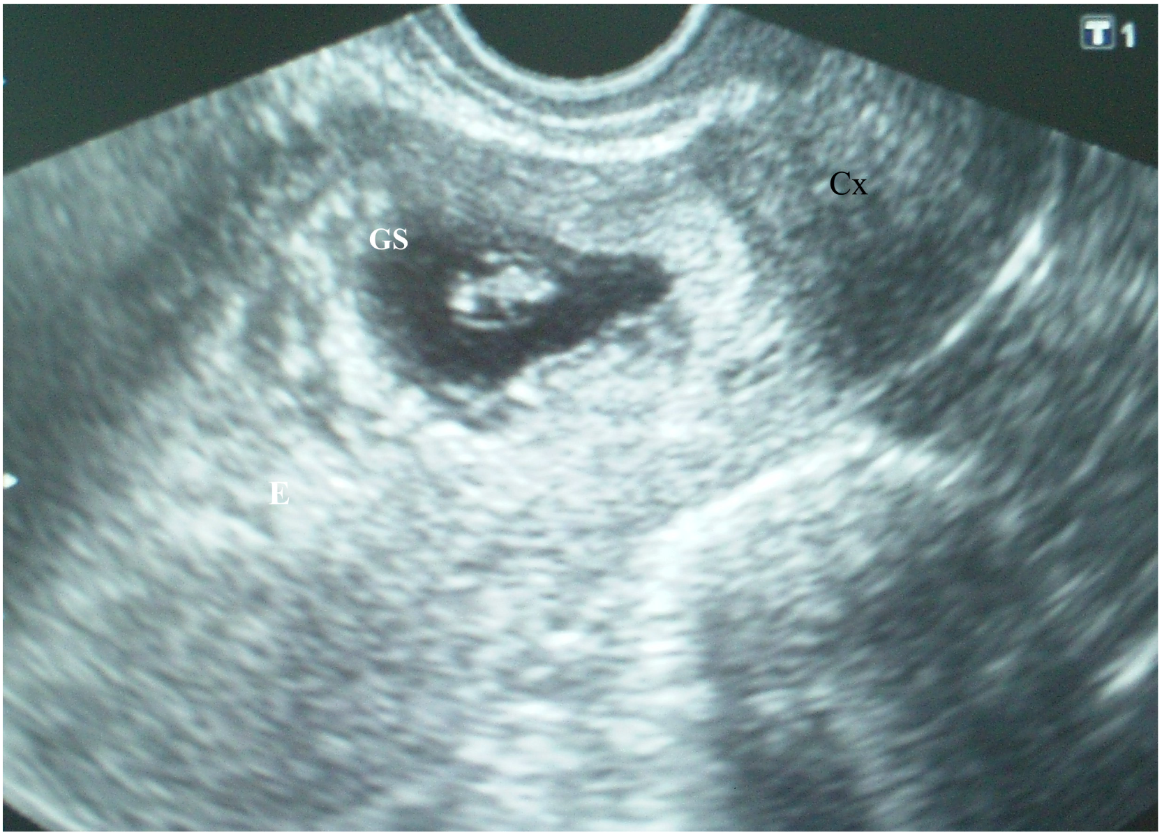 Medicina 56 00496 g002