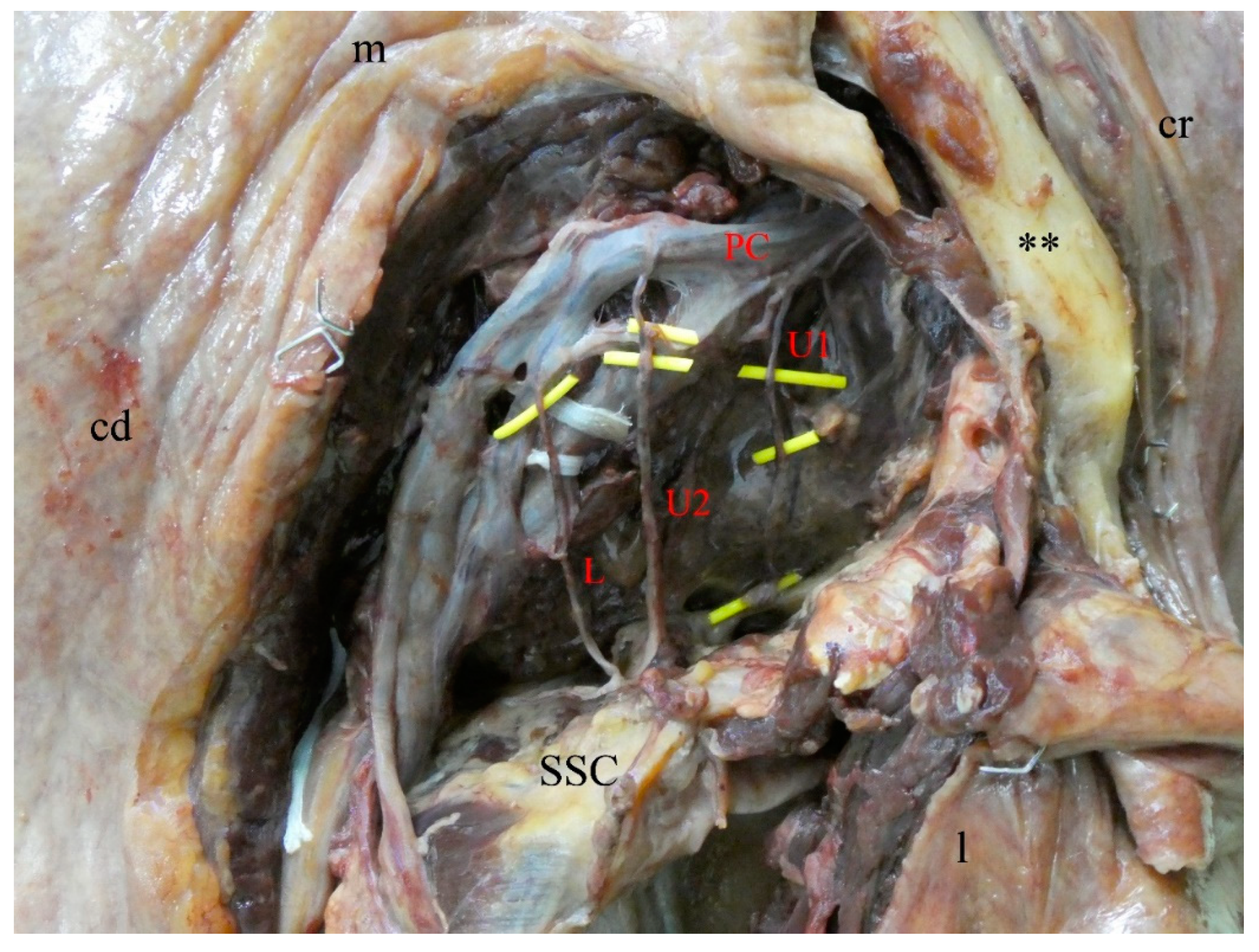 Medicina 56 00532 g001 Medicina 56 00532 g001