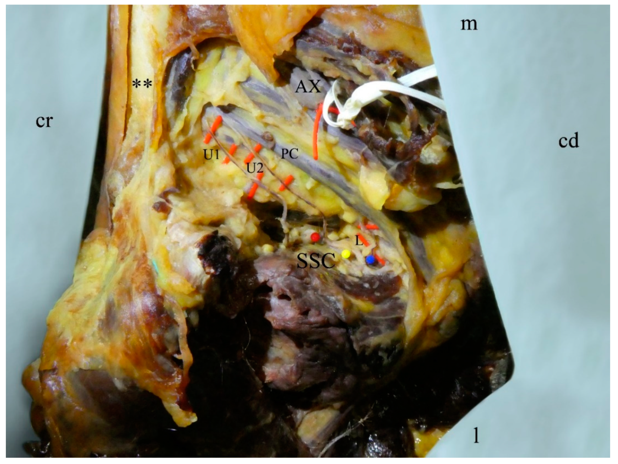 Medicina 56 00532 g002 Medicina 56 00532 g002