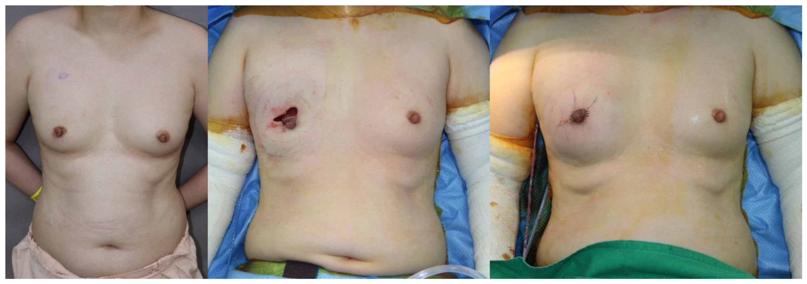 Medicina 56 00537 g002 Medicina 56 00537 g002