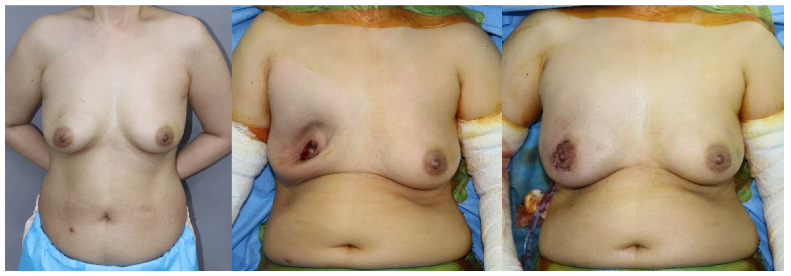 Medicina 56 00537 g003 Medicina 56 00537 g003