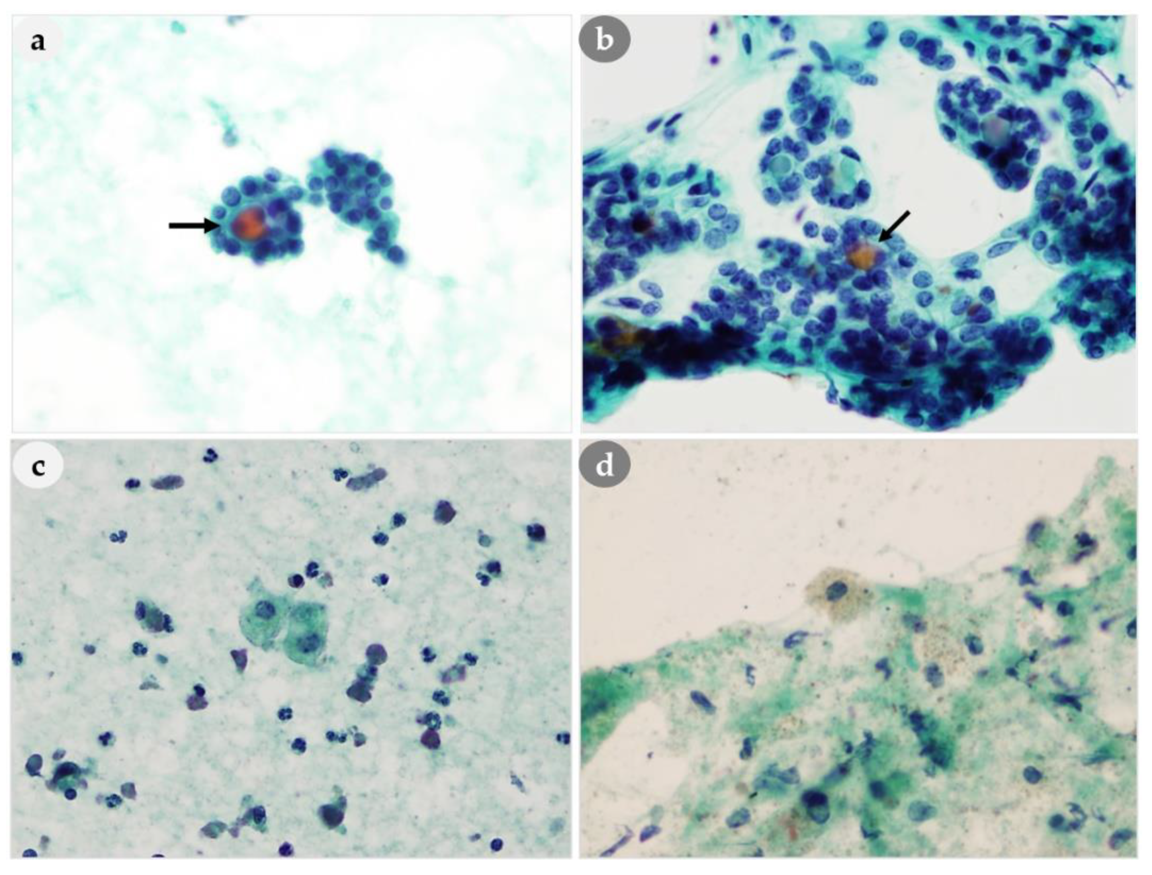 Medicina 56 00558 g006