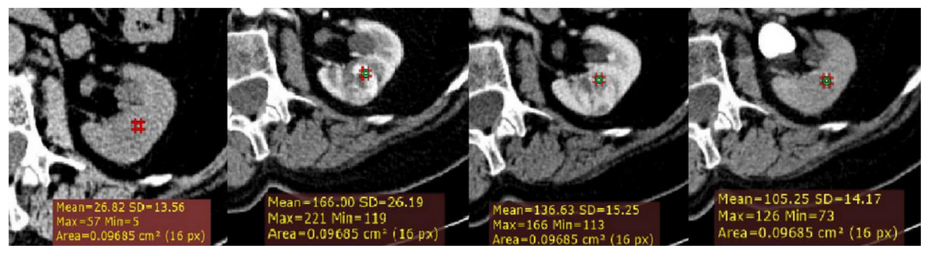 Medicina 56 00569 g001 Medicina 56 00569 g001