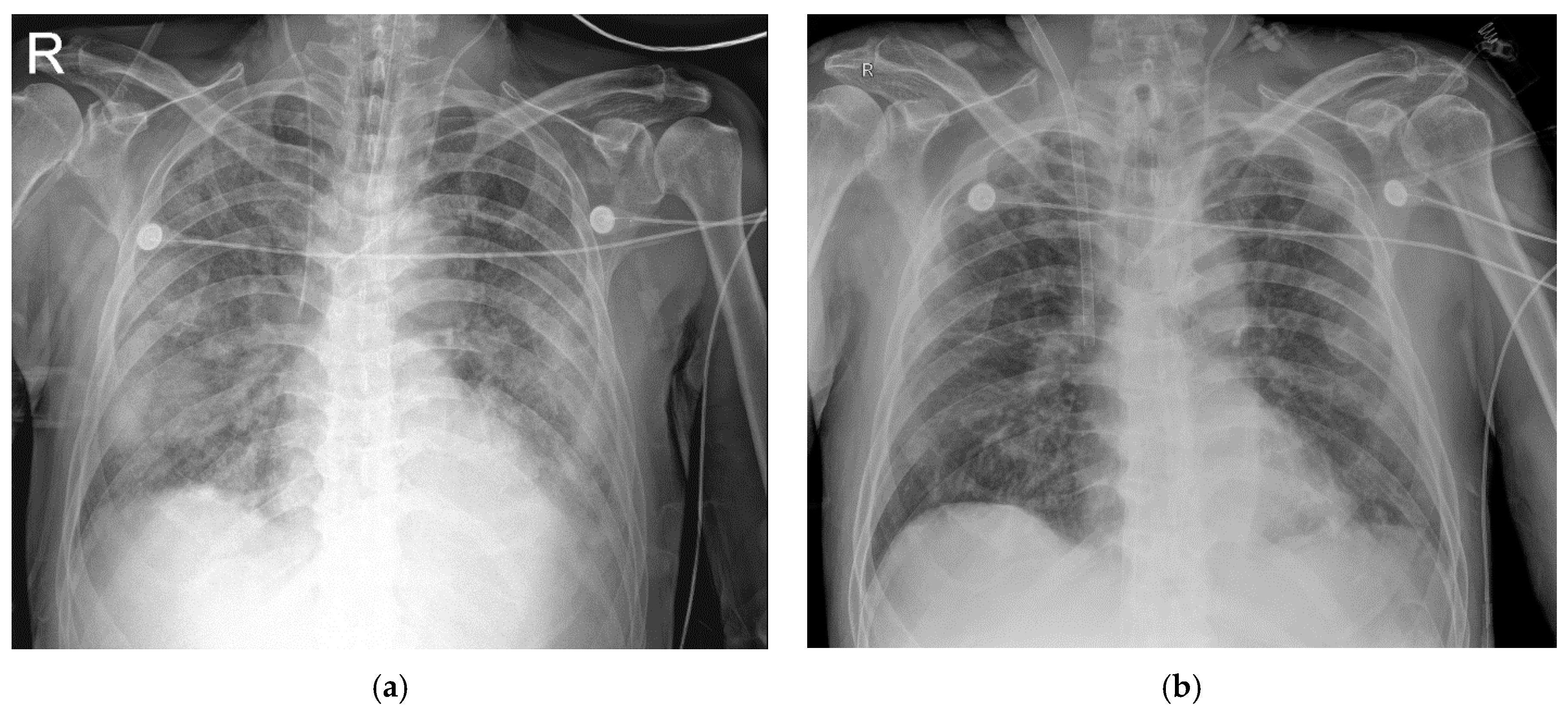 Medicina 56 00570 g002