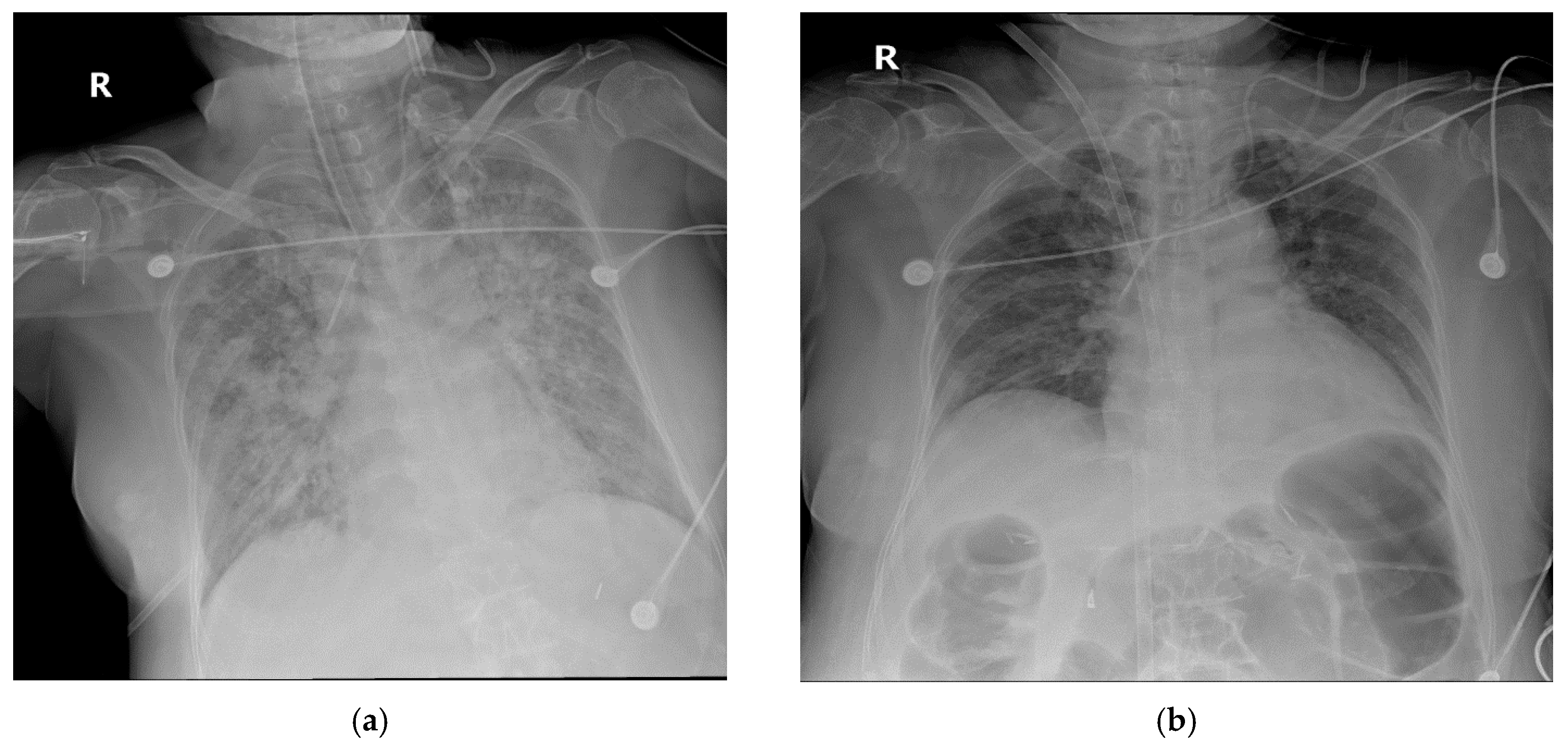 Medicina 56 00570 g004