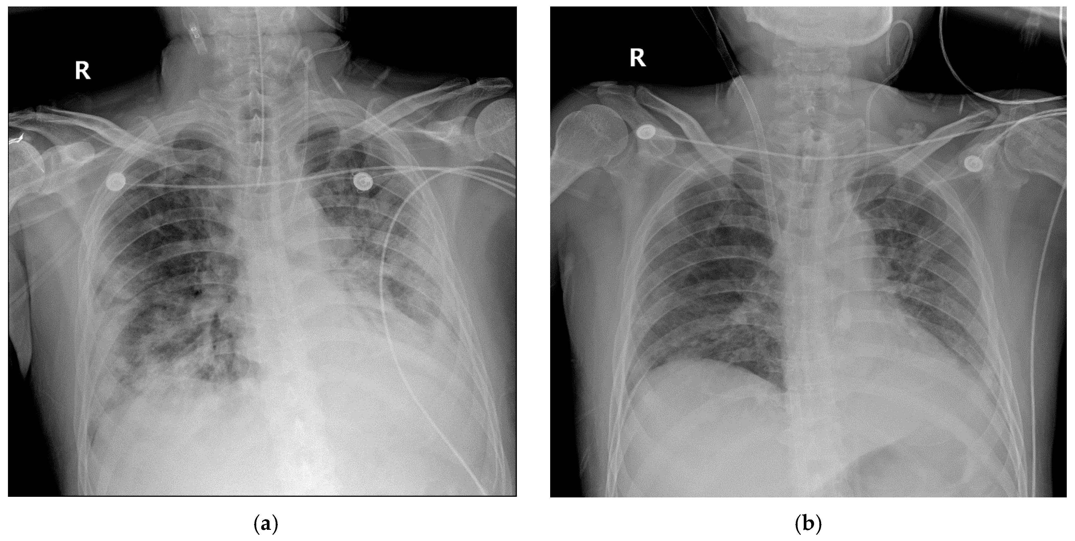 Medicina 56 00570 g006