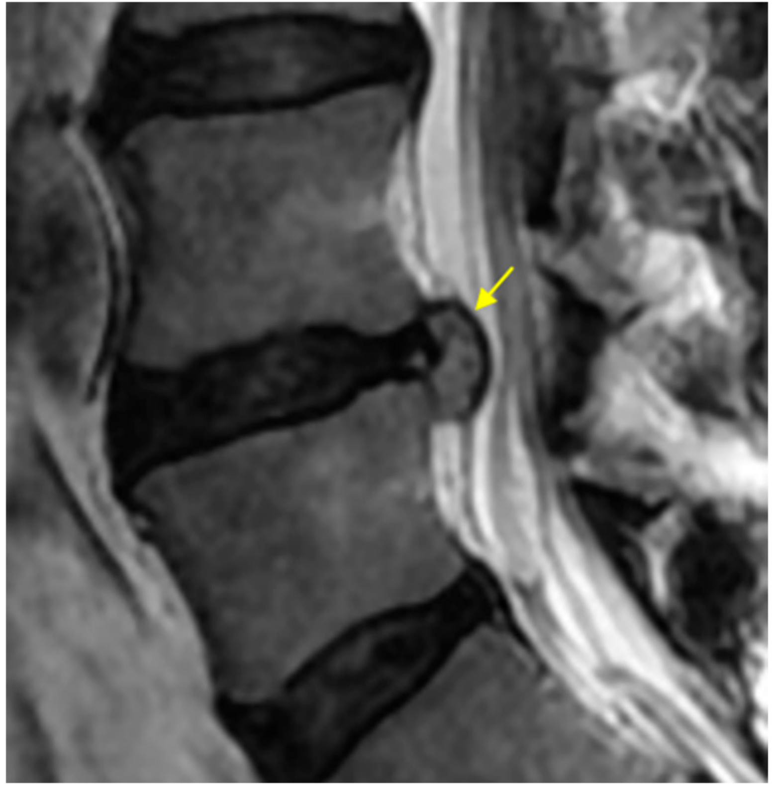 Medicina 56 00627 g004