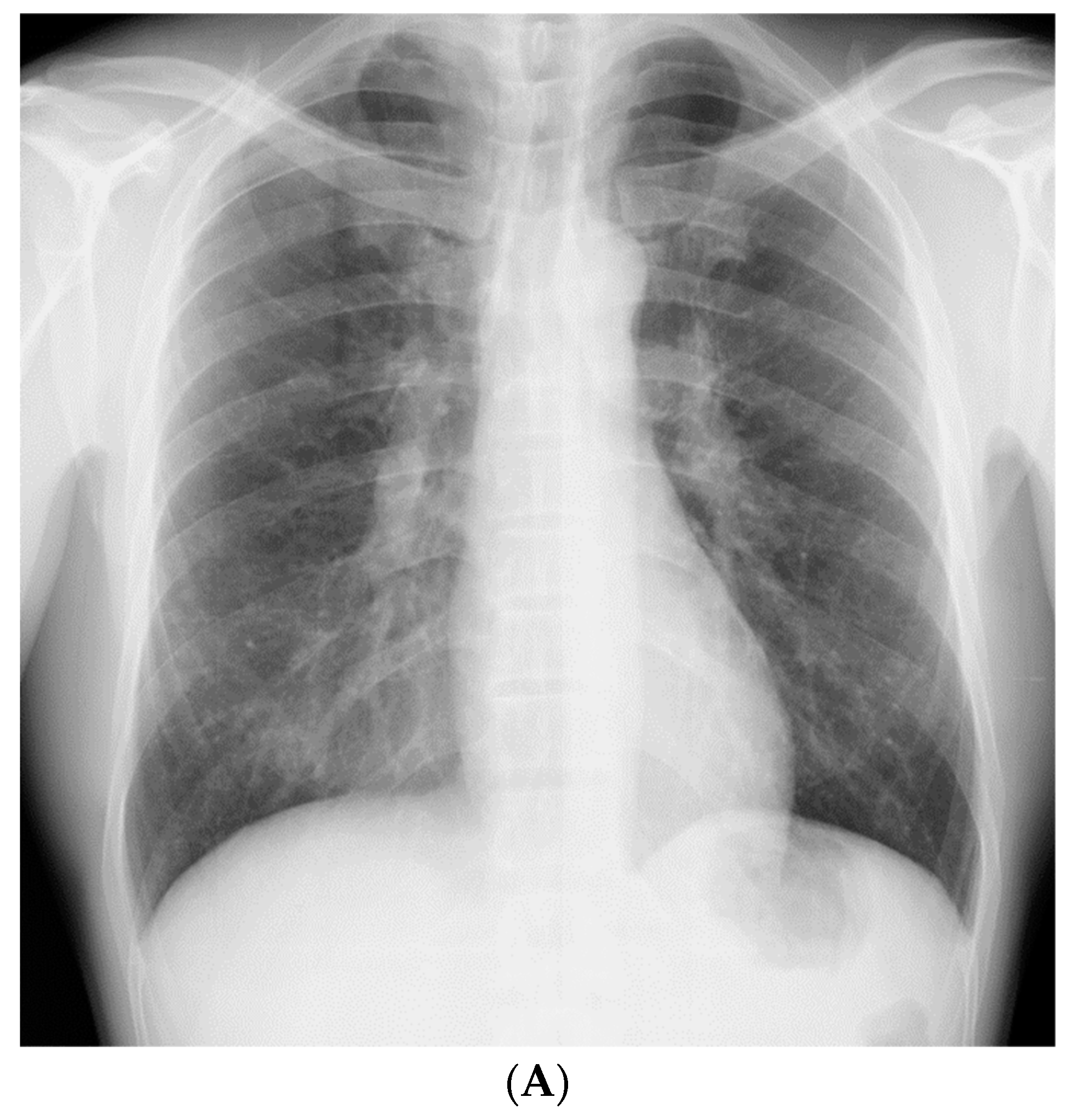 Medicina 56 00630 g001a Medicina 56 00630 g001a