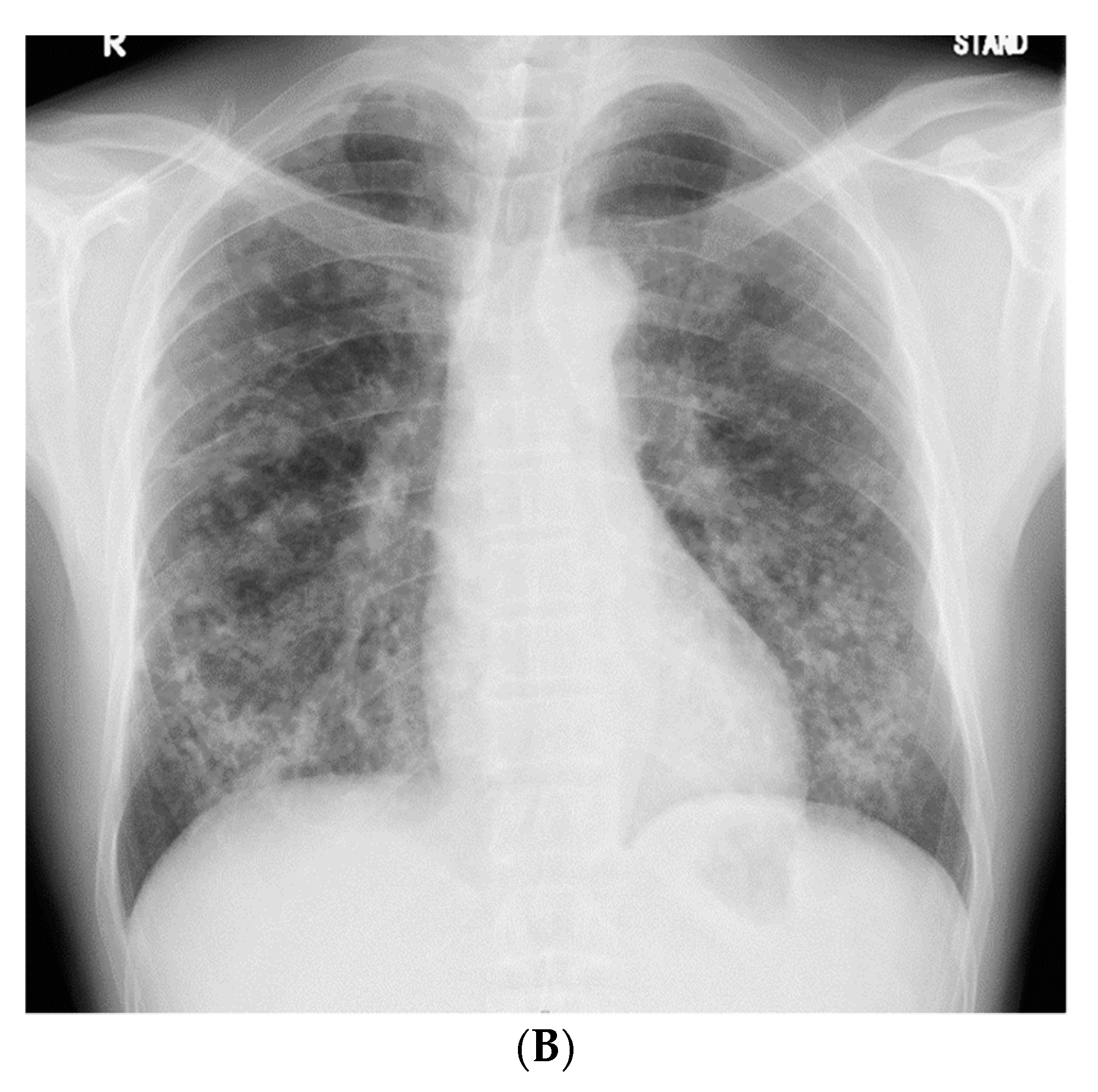 Medicina 56 00630 g001b Medicina 56 00630 g001b