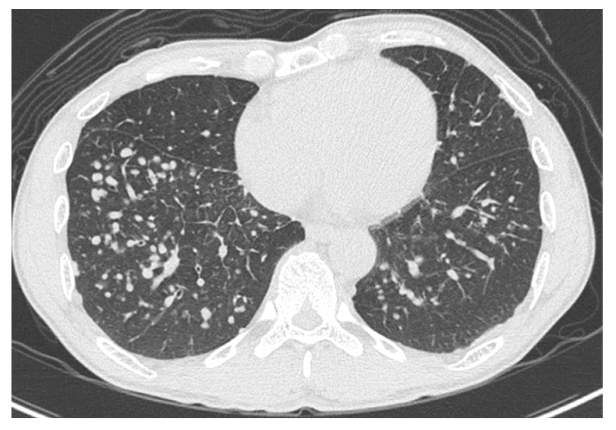 Medicina 56 00630 g002 Medicina 56 00630 g002