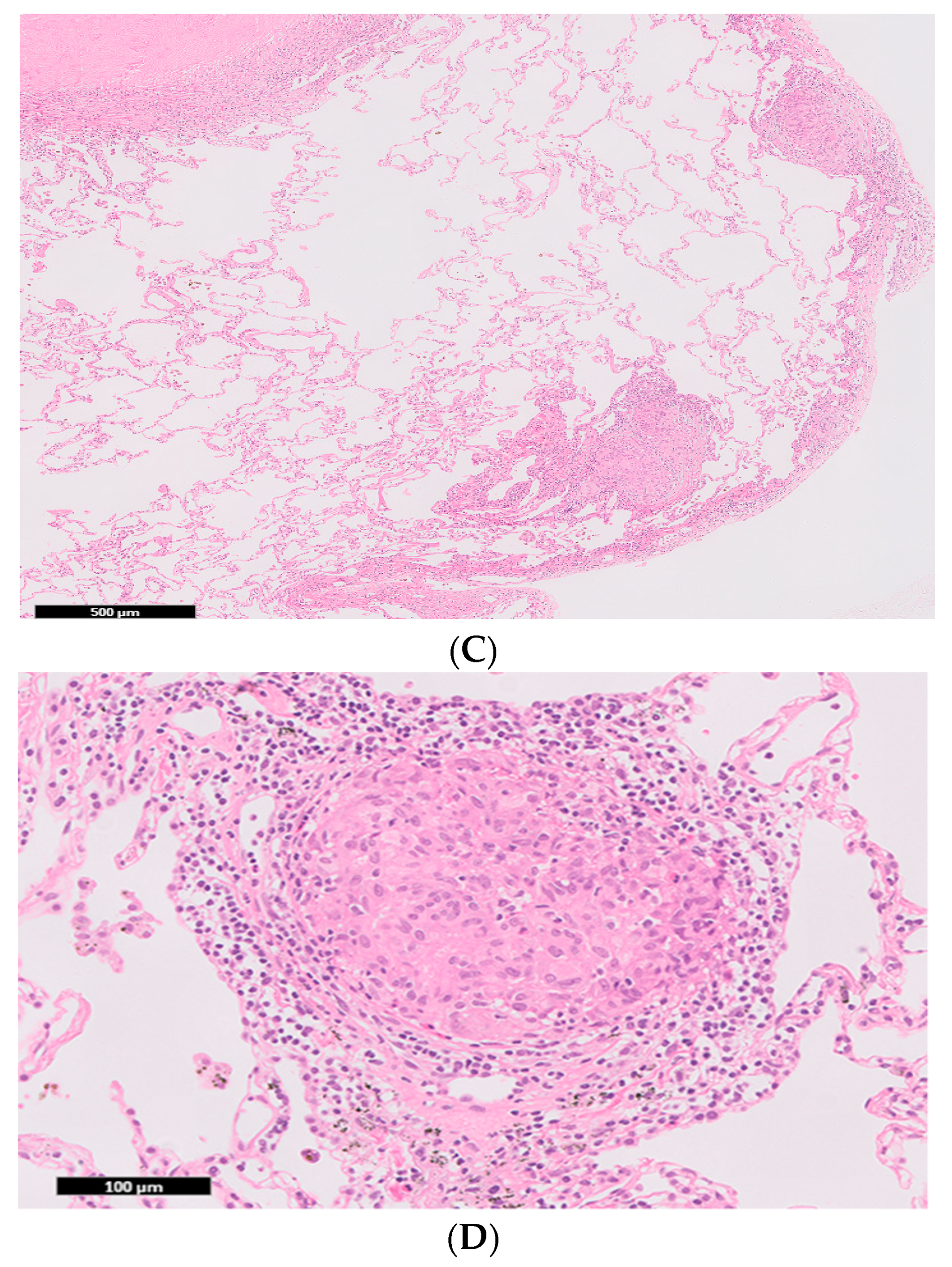Medicina 56 00630 g003b Medicina 56 00630 g003b