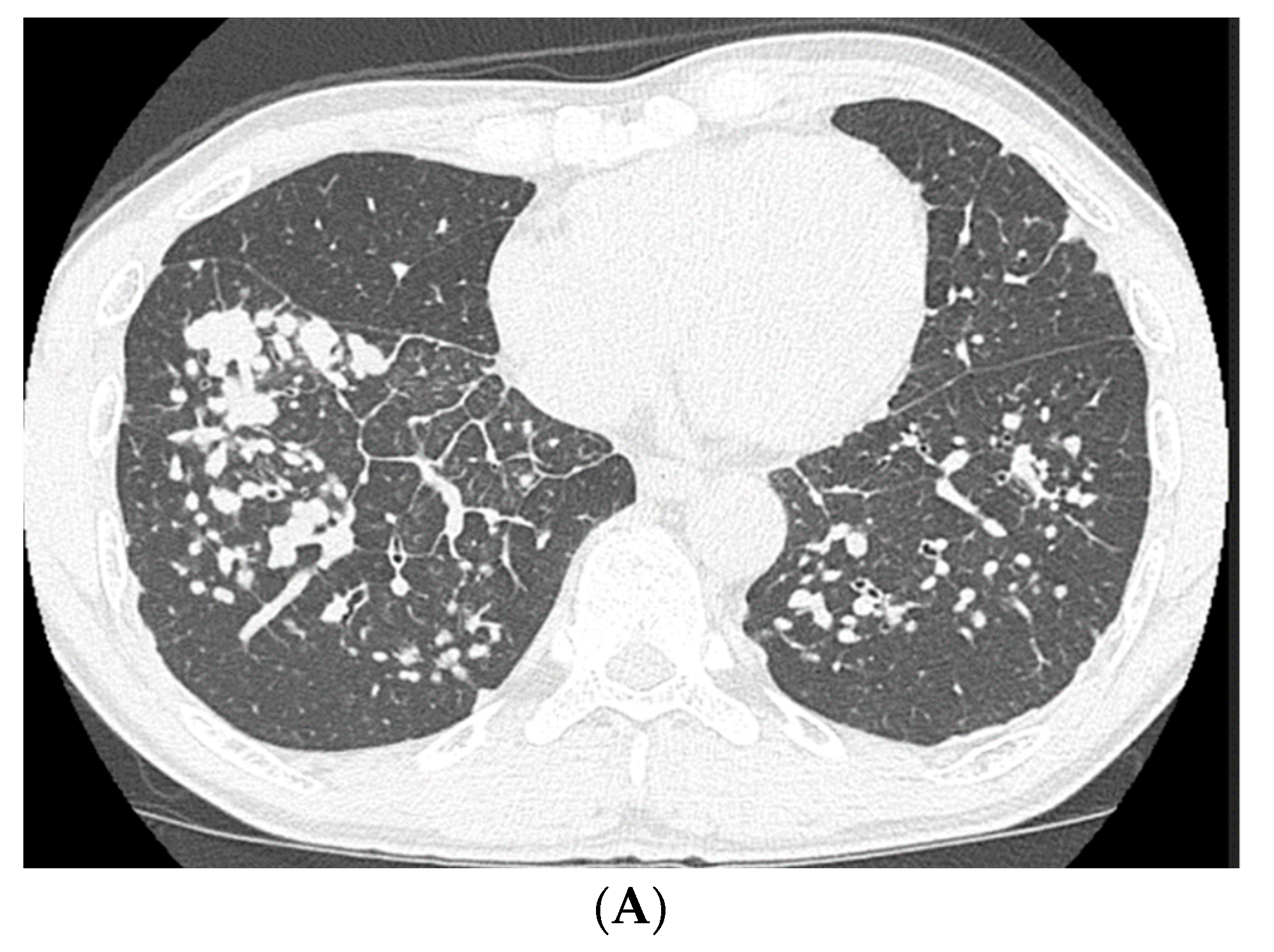 Medicina 56 00630 g005a Medicina 56 00630 g005a