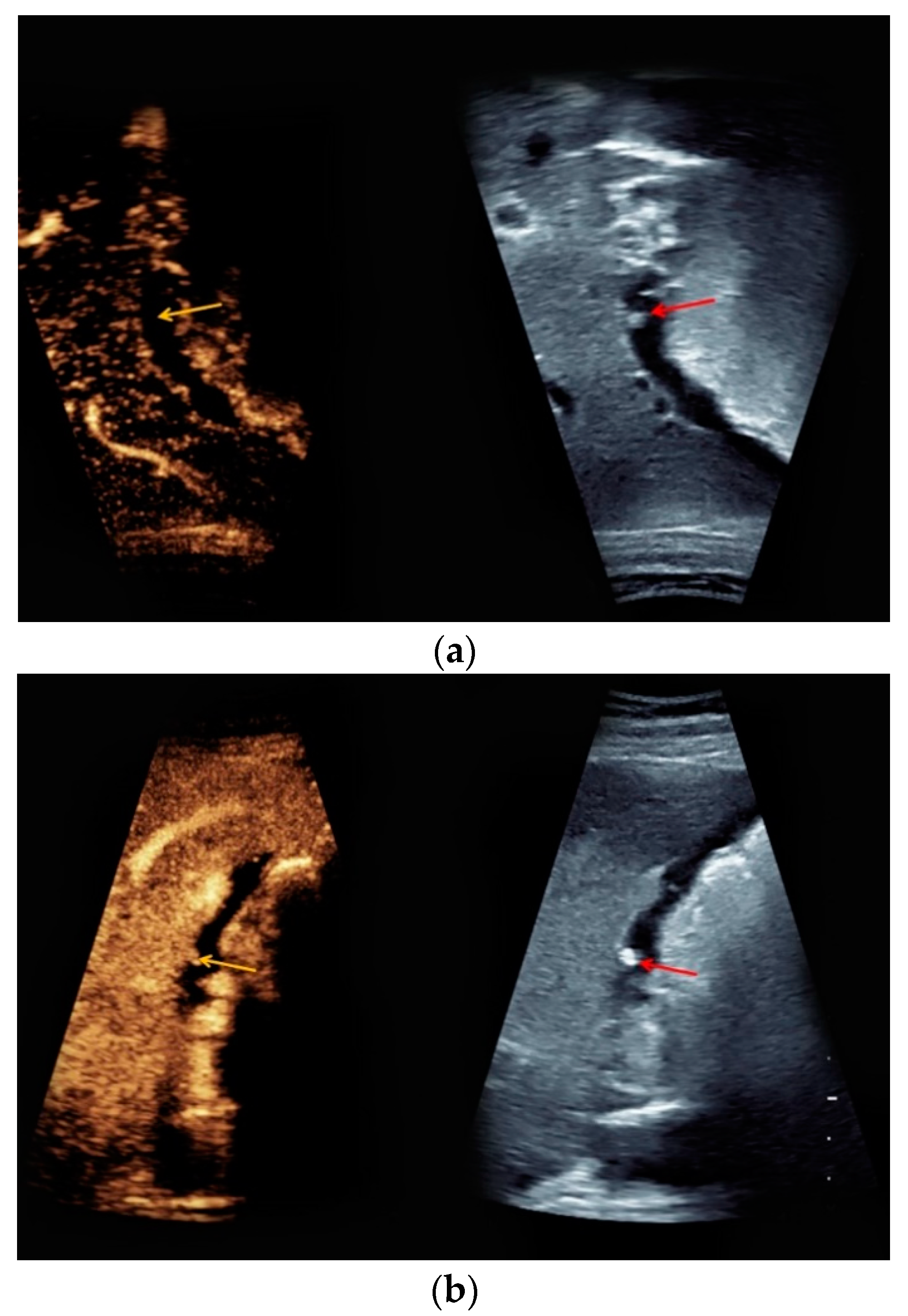 Medicina 56 00675 g003