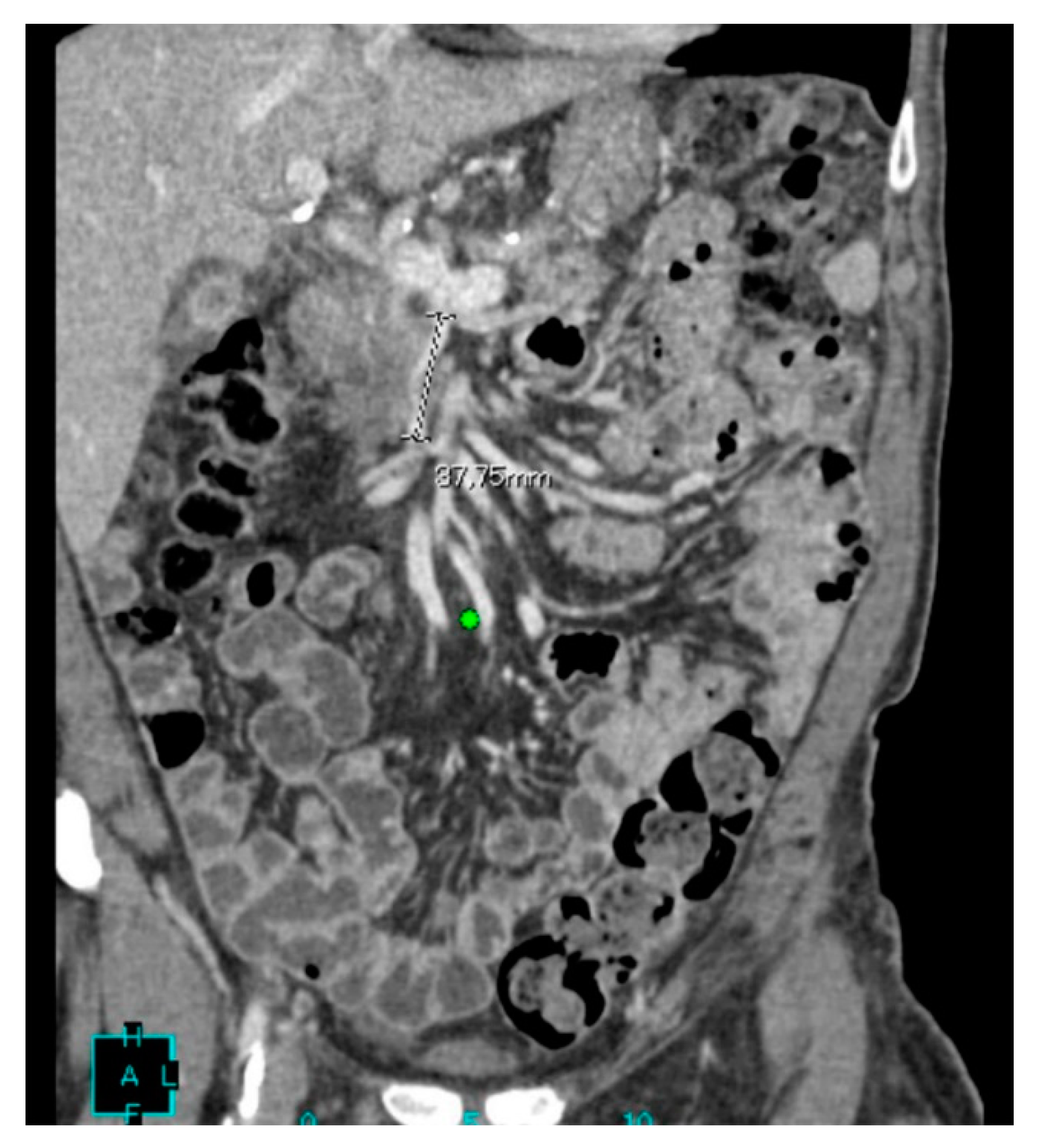 Medicina 56 00708 g001