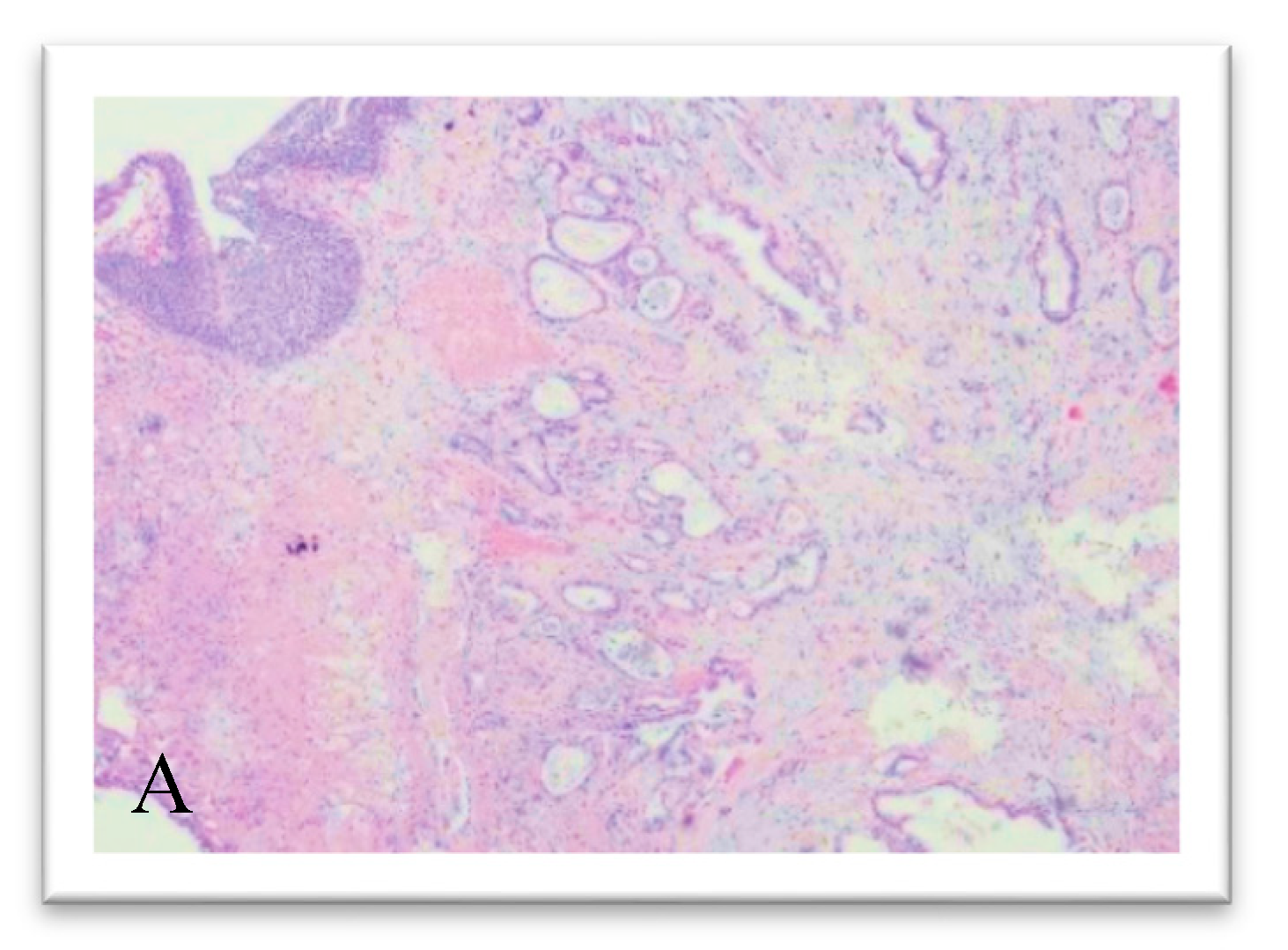 Medicina 56 00708 g002a