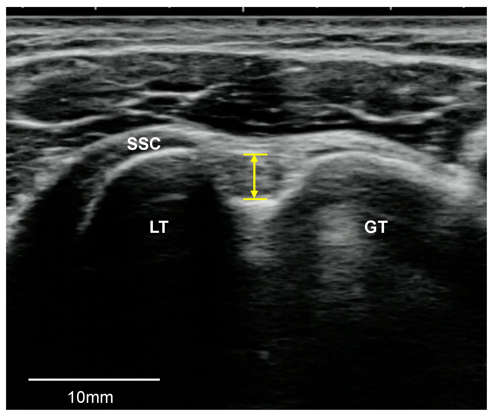 Medicina 57 00029 g001