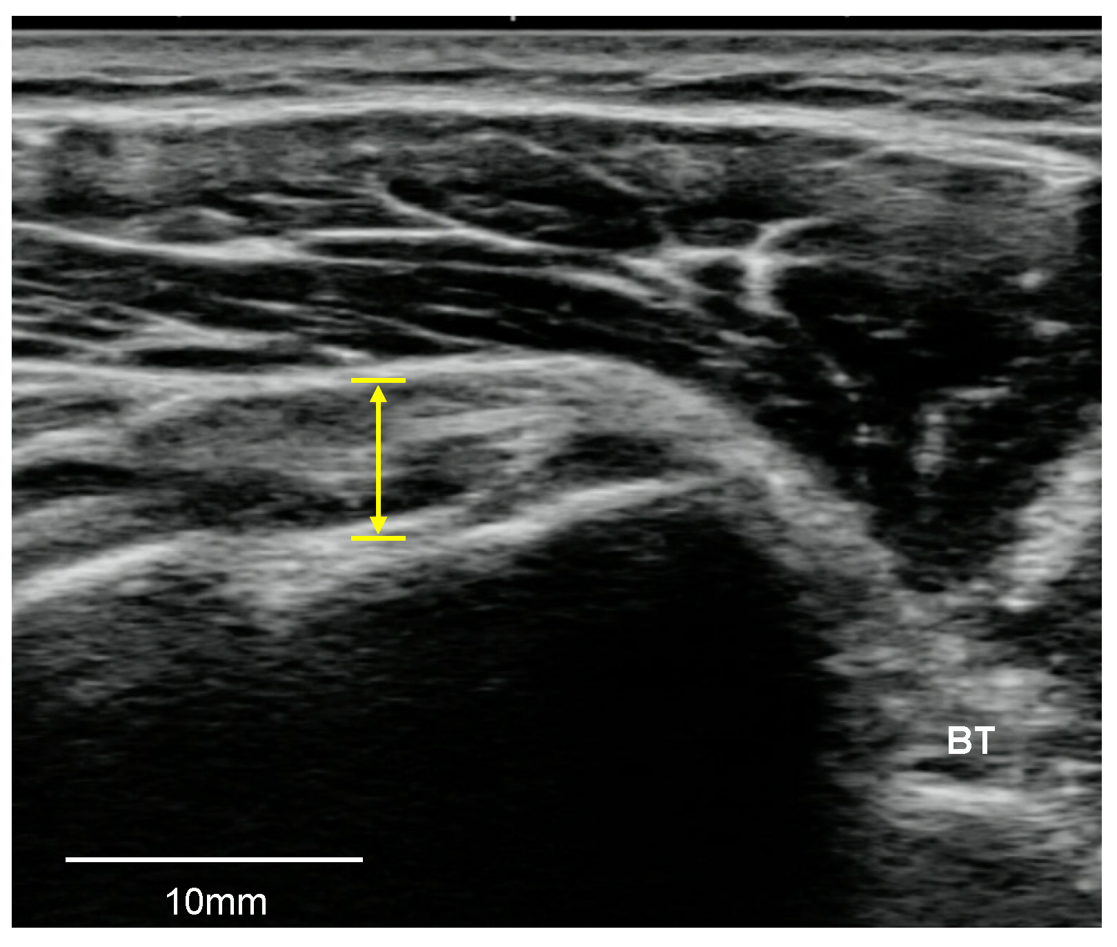 Medicina 57 00029 g003