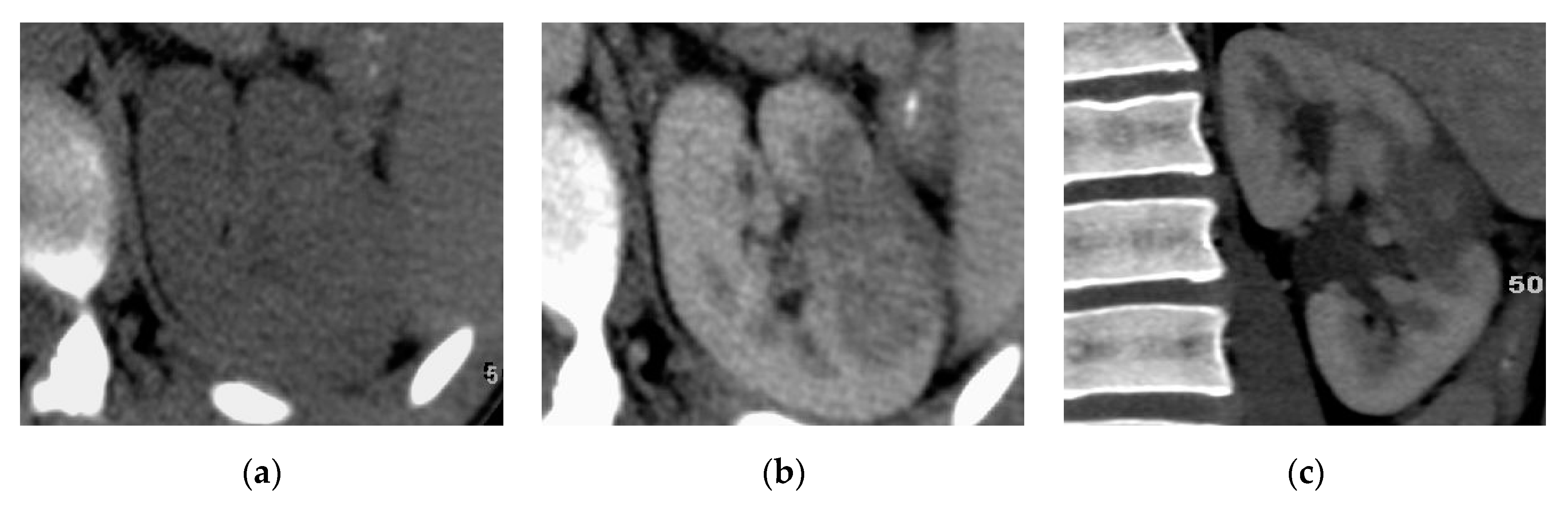 Medicina 57 00032 g003