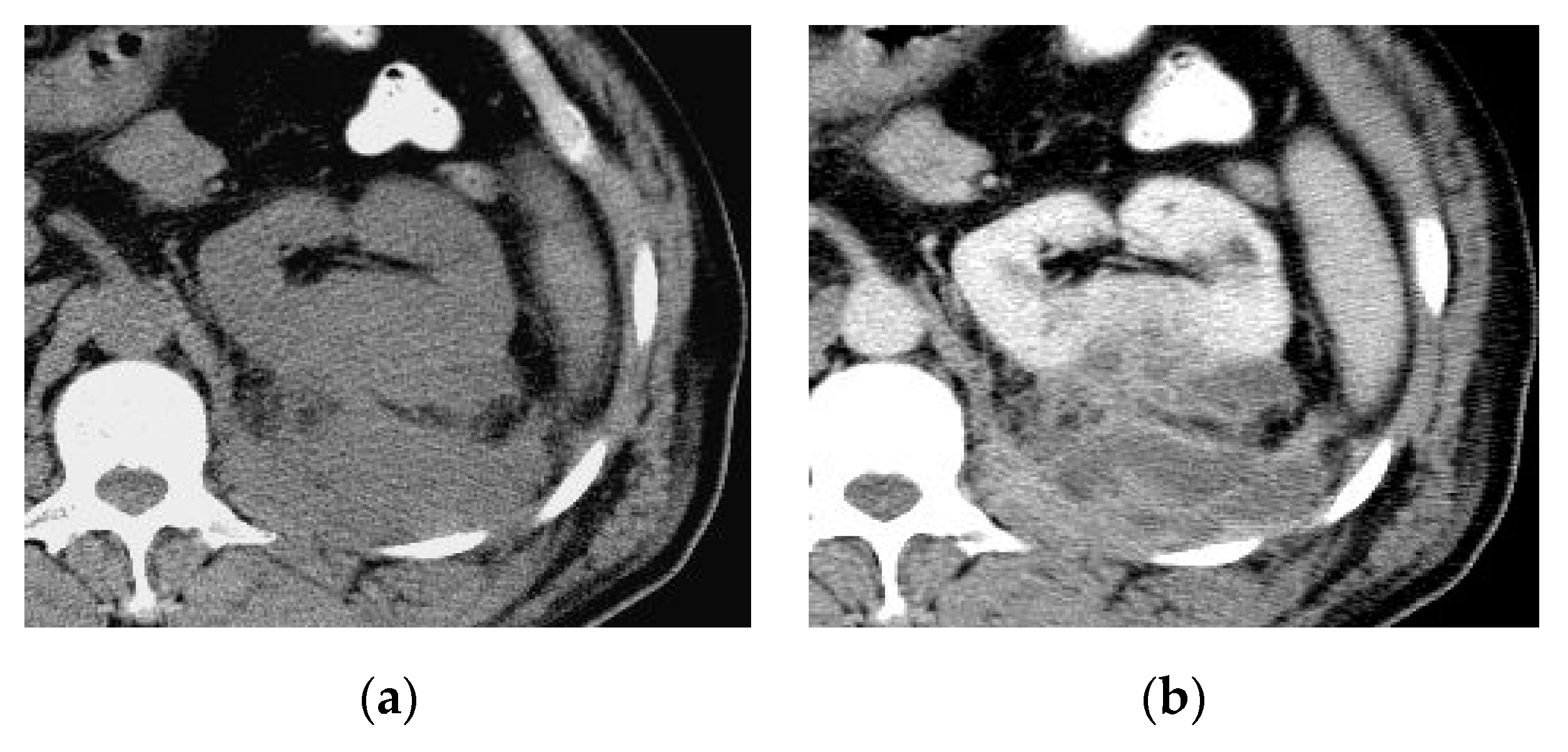 Medicina 57 00032 g004