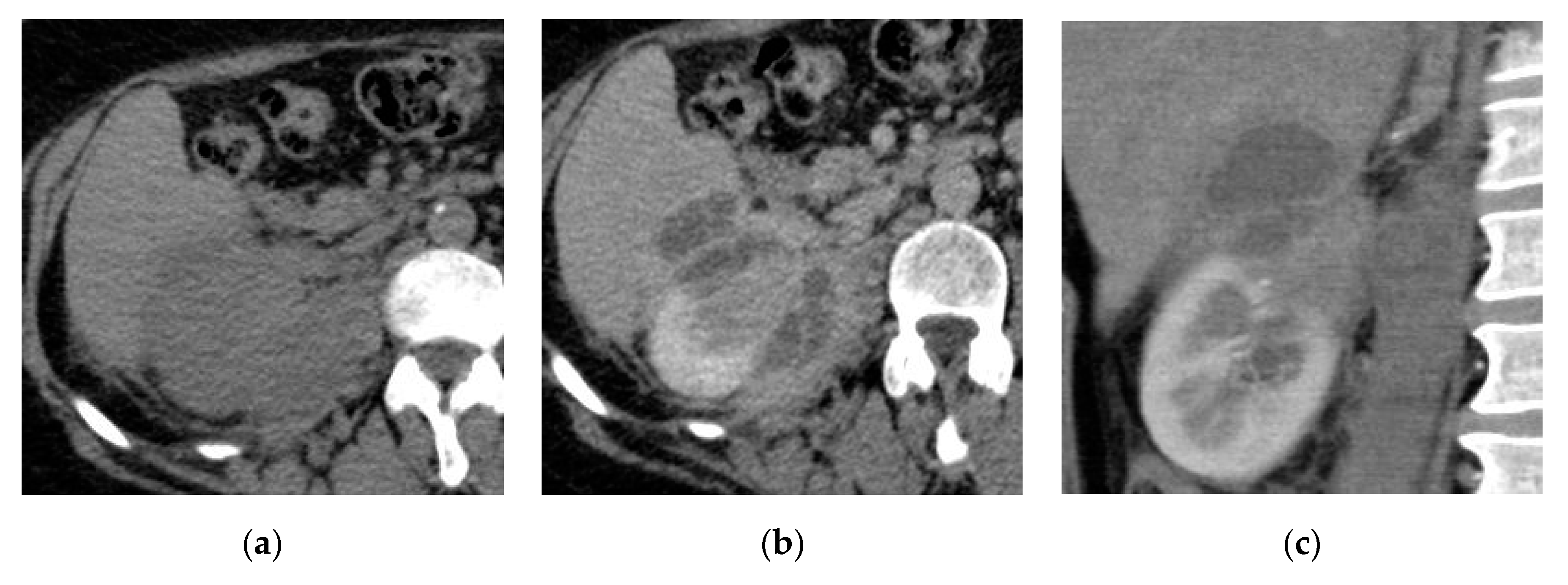 Medicina 57 00032 g006