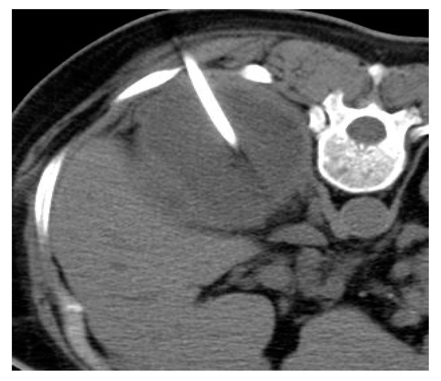 Medicina 57 00032 g007