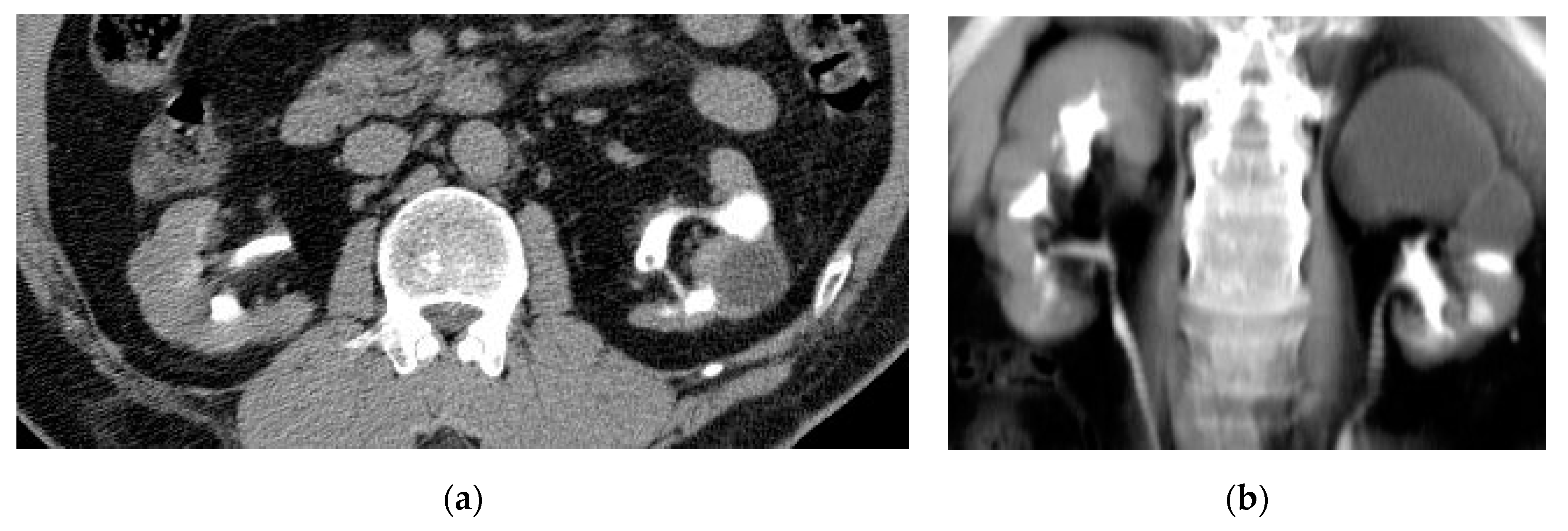 Medicina 57 00032 g011