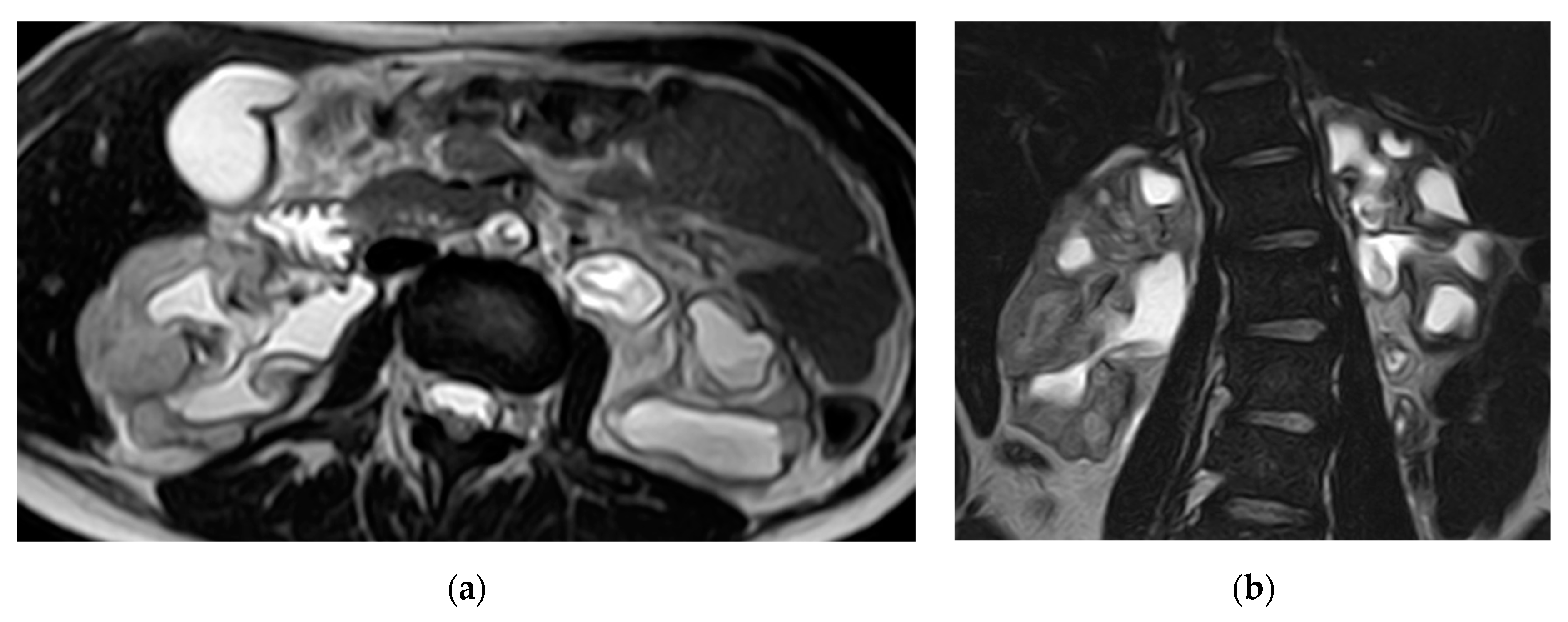 Medicina 57 00032 g012