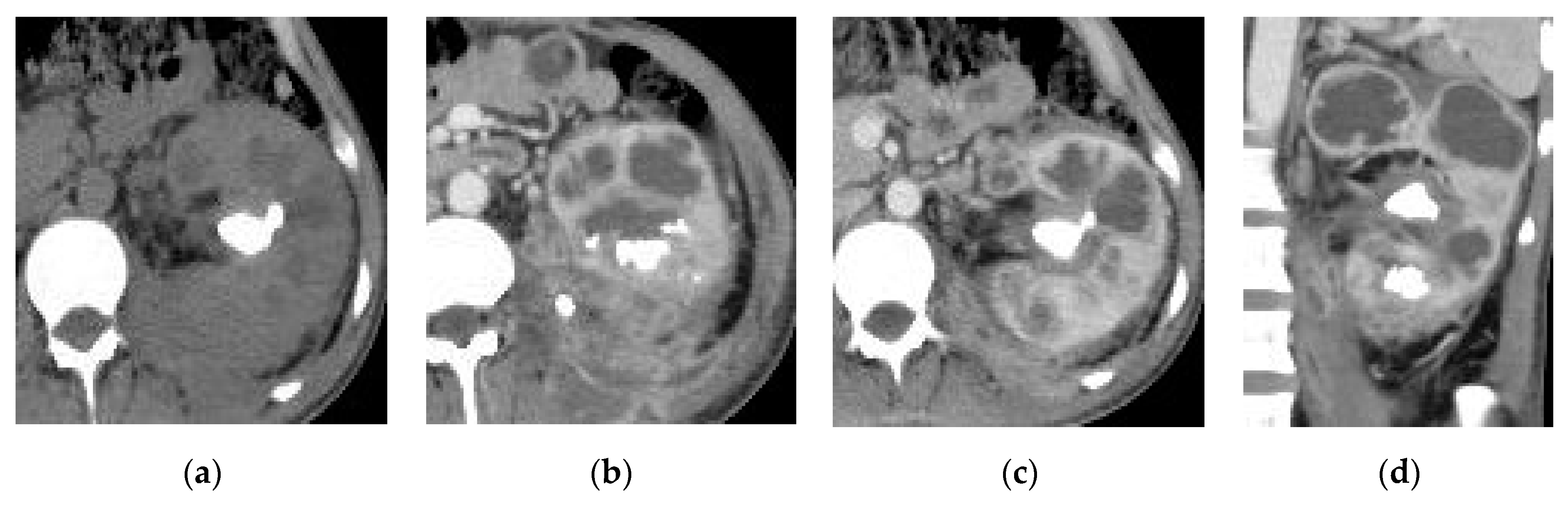 Medicina 57 00032 g014