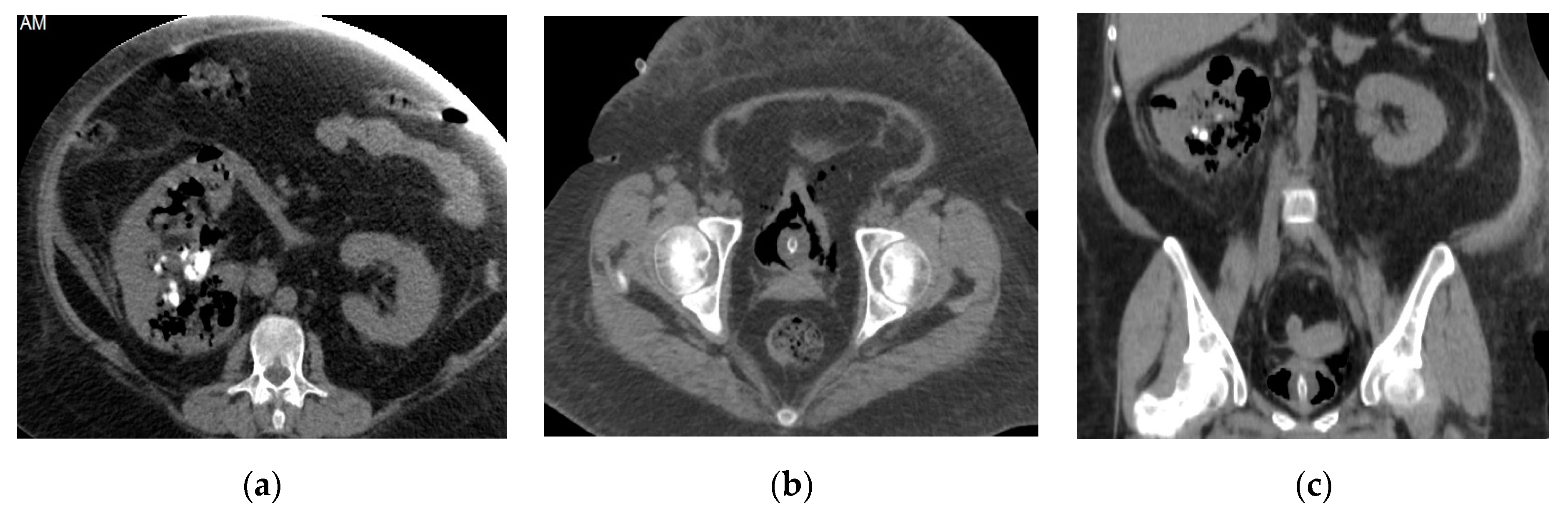 Medicina 57 00032 g016