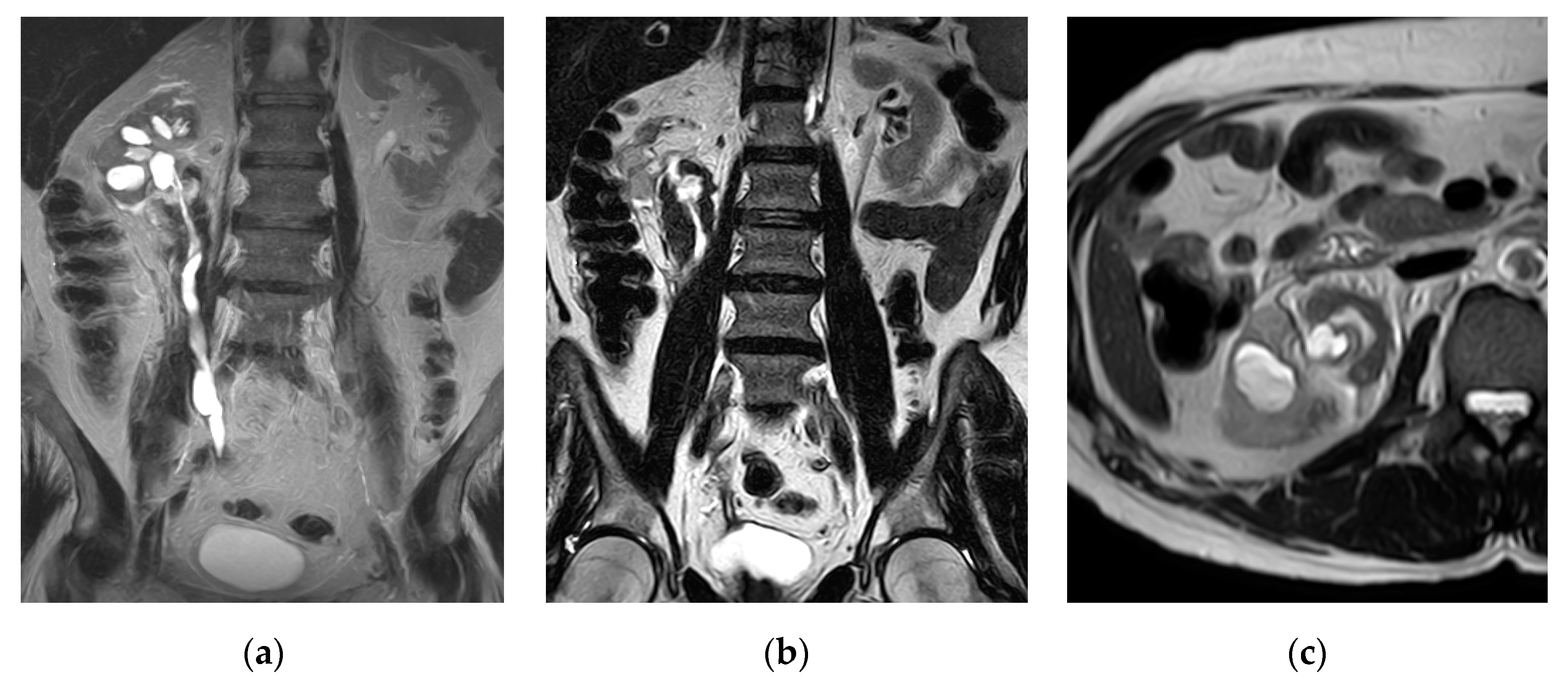 Medicina 57 00032 g017