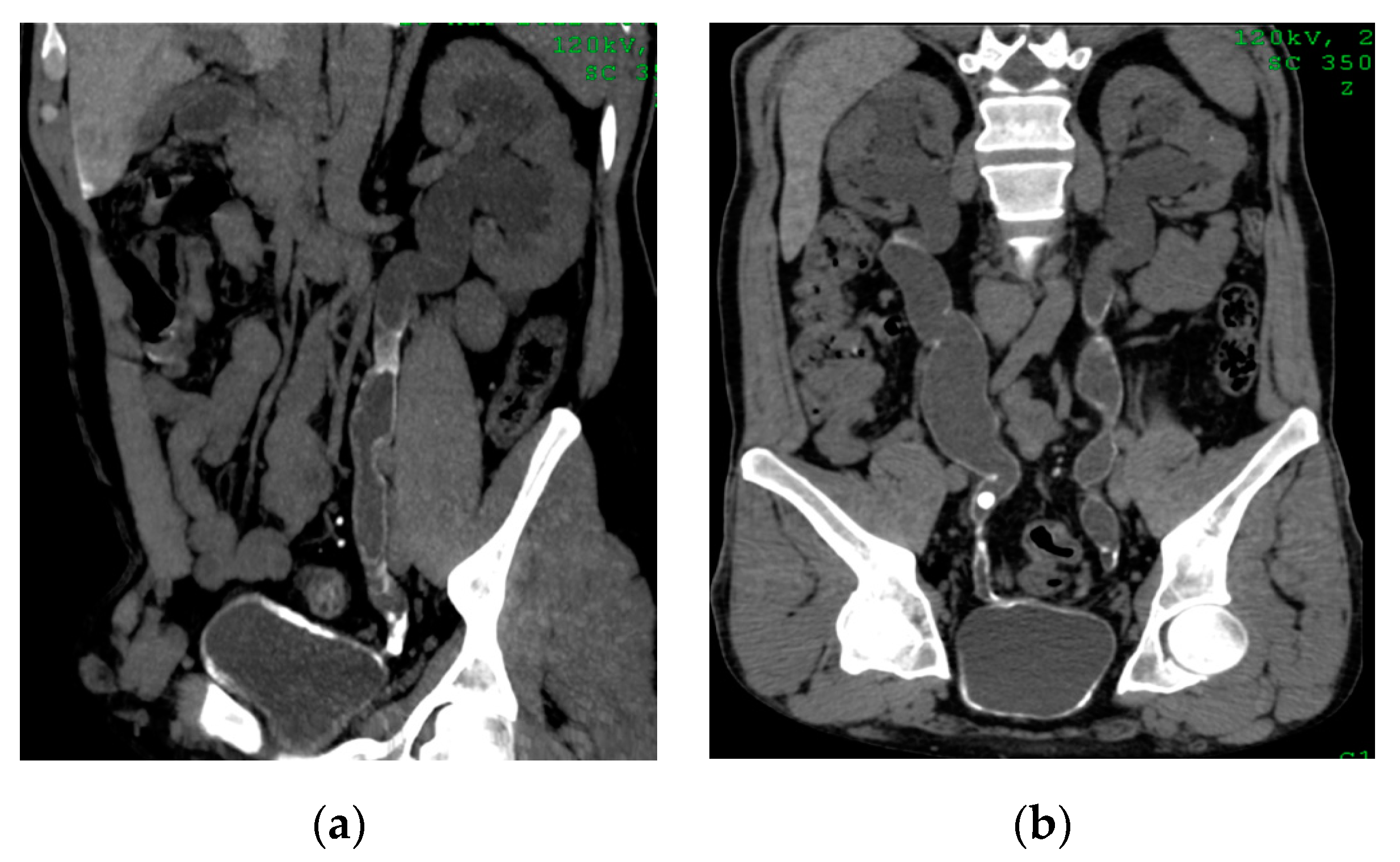 Medicina 57 00032 g018