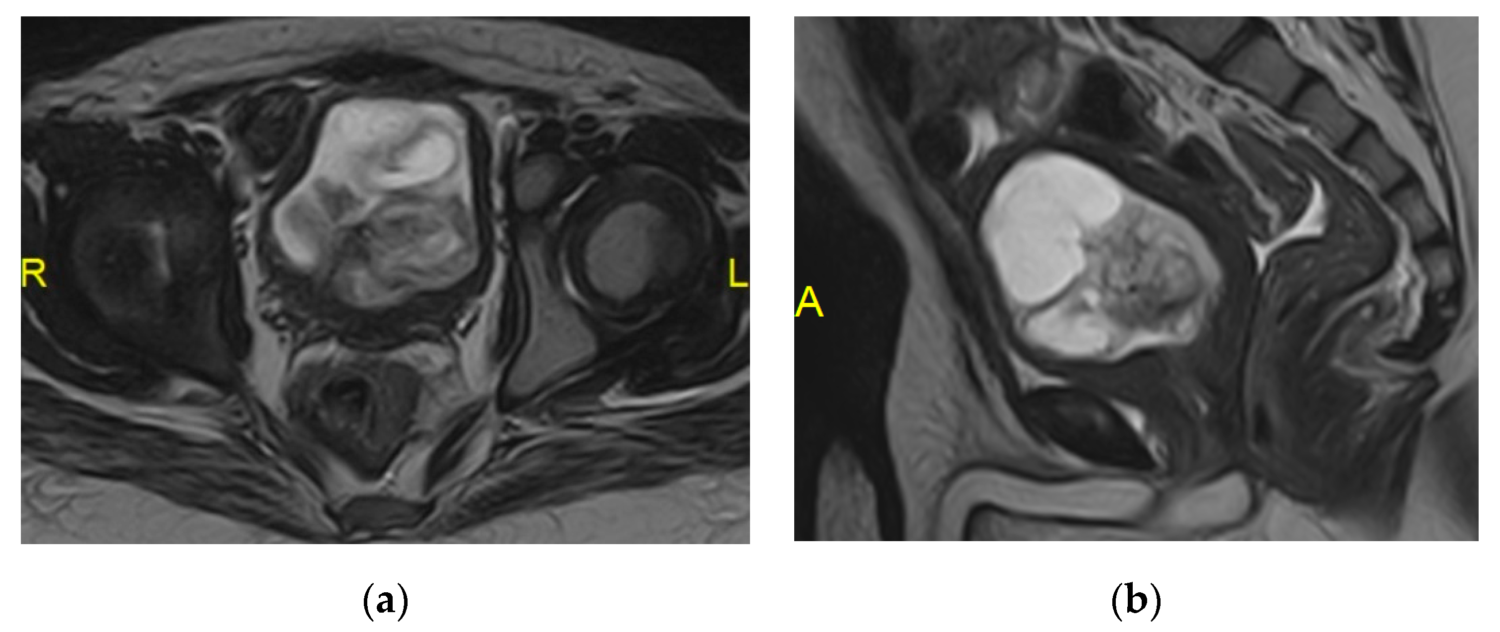 Medicina 57 00032 g025
