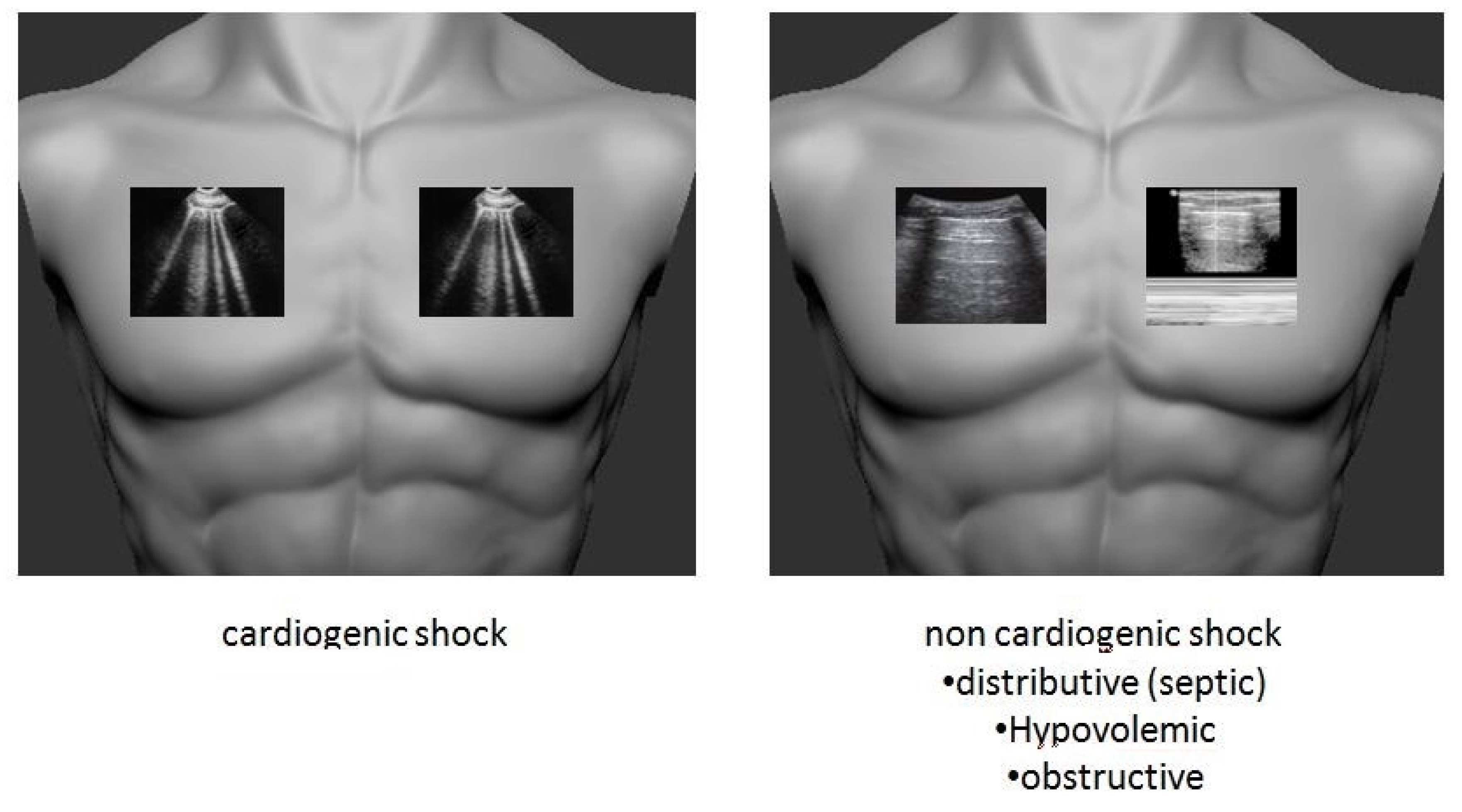 Medicina 57 00069 g002