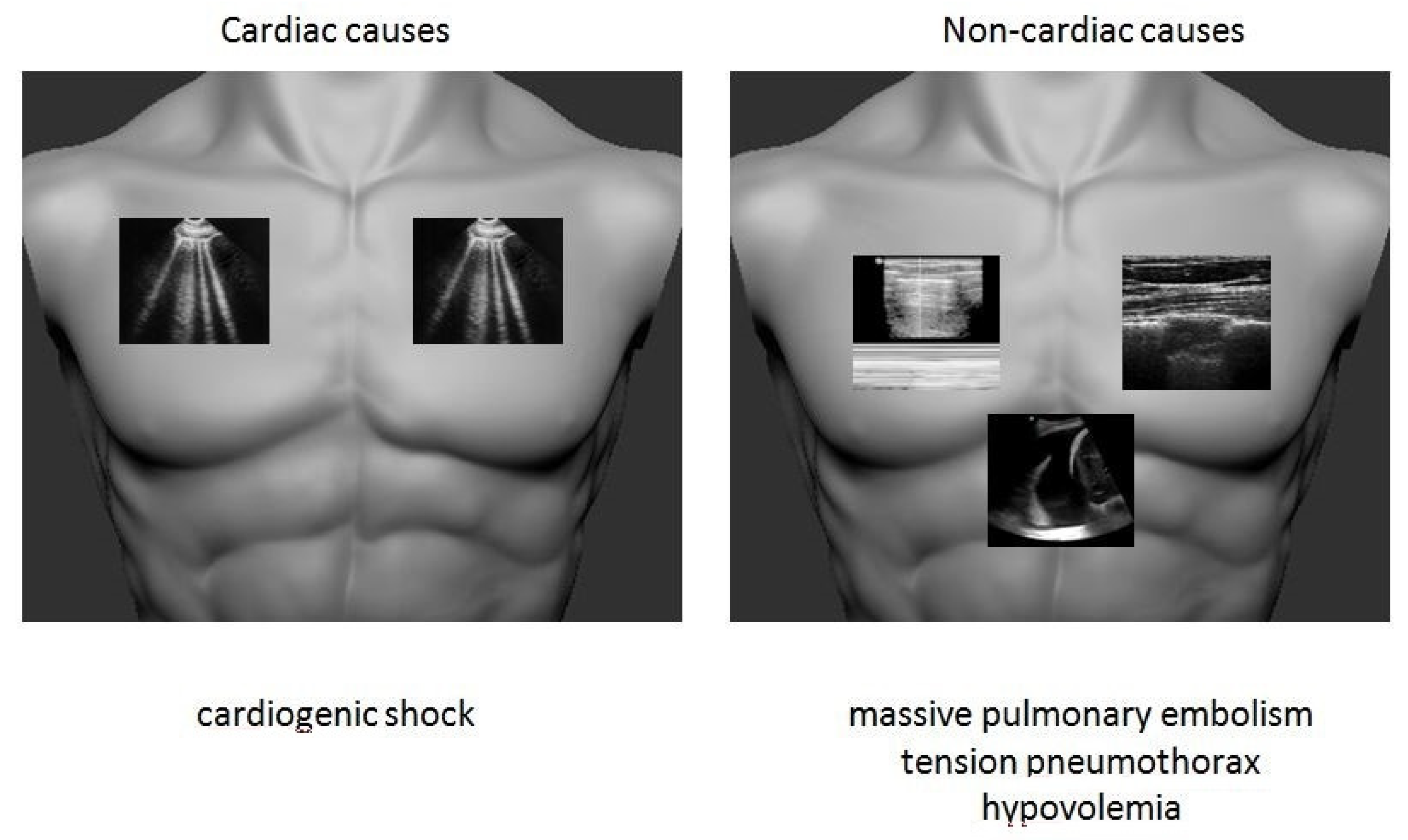 Medicina 57 00069 g004