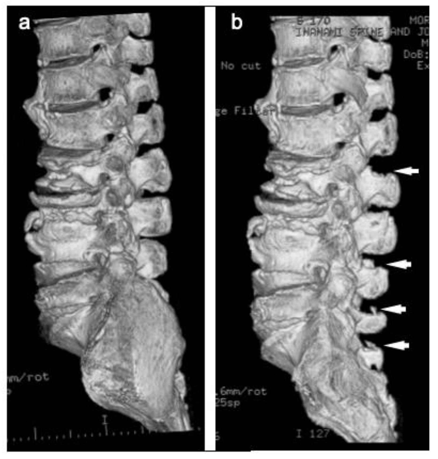 Medicina 57 00087 g005