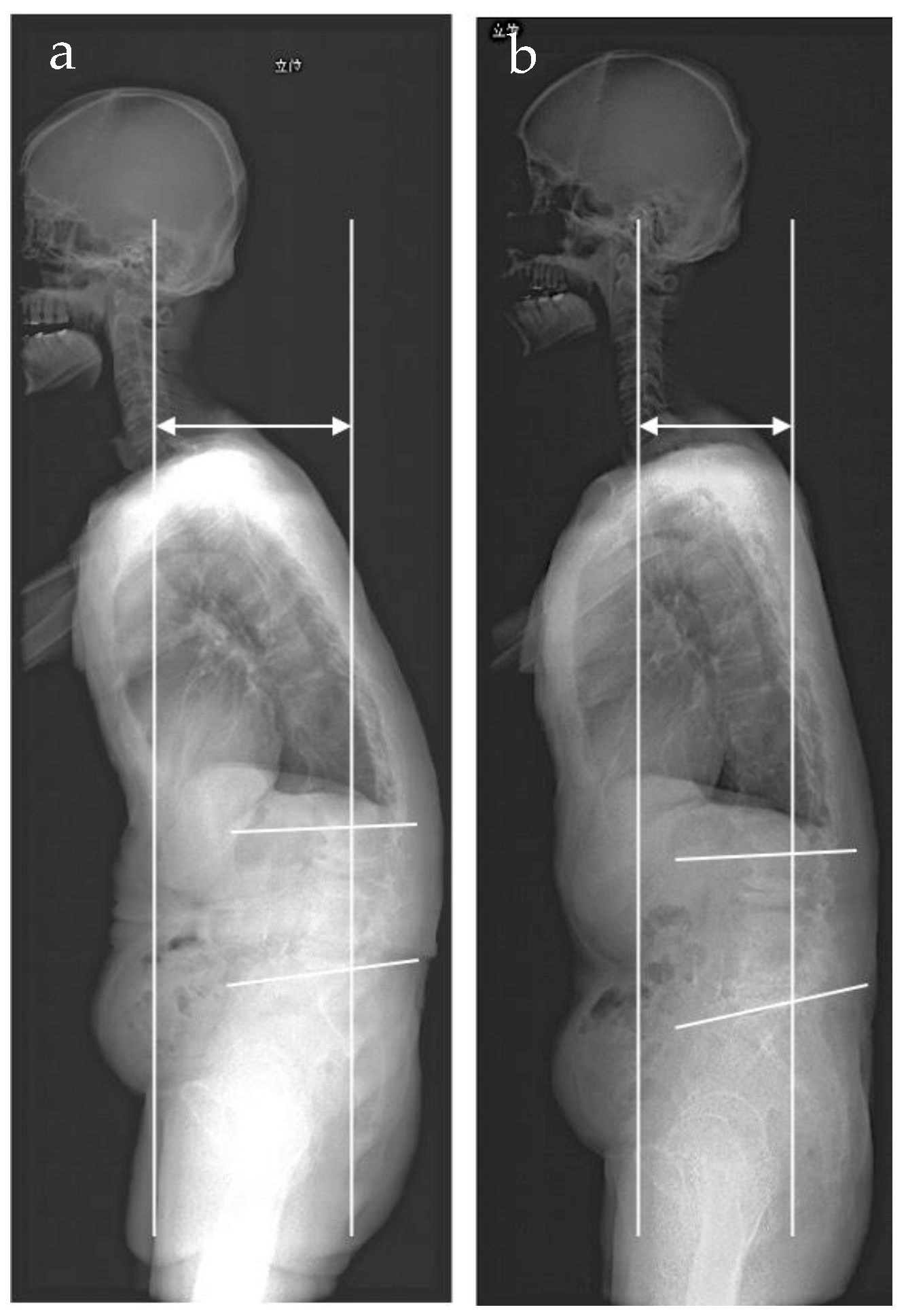 Medicina 57 00087 g006