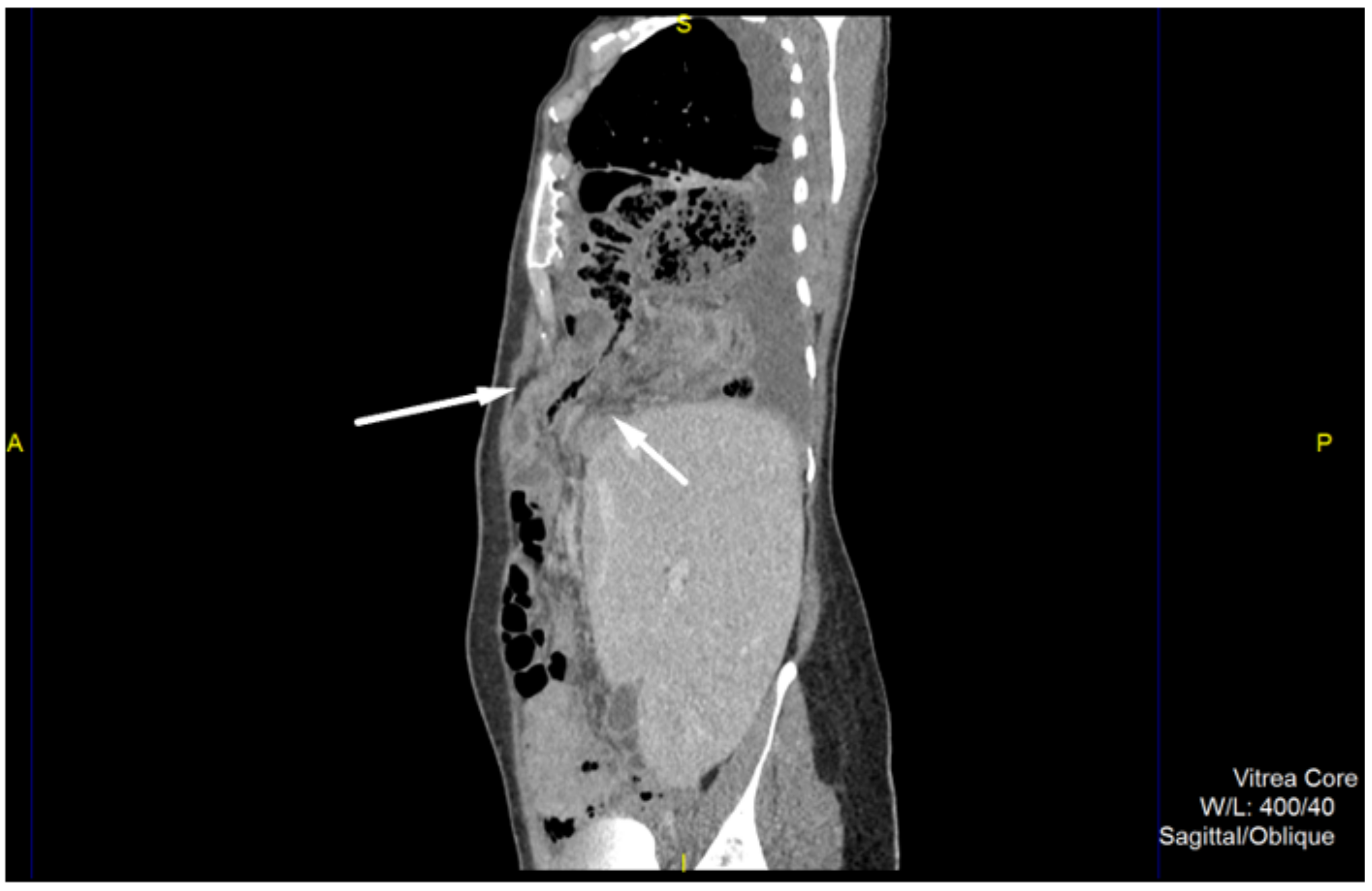 Medicina 57 00089 g001