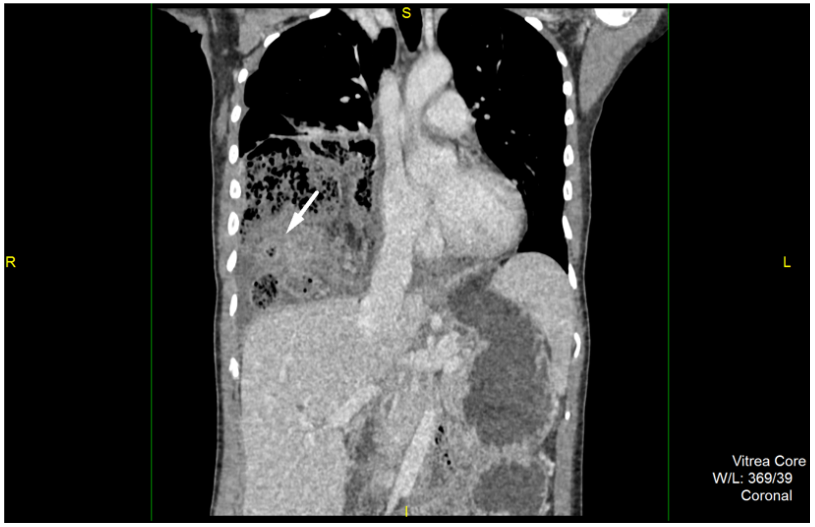 Medicina 57 00089 g002