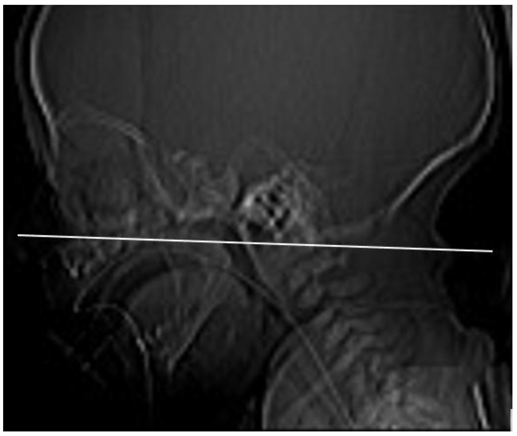 Medicina 57 00093 g001 Medicina 57 00093 g001