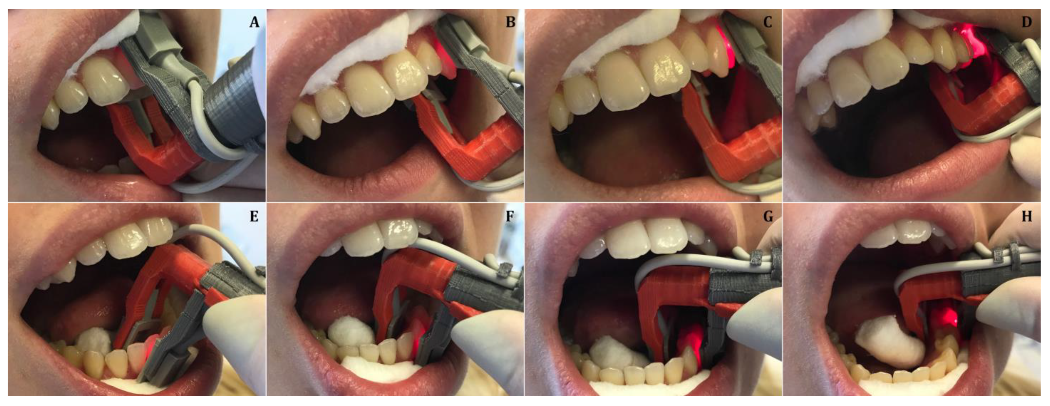 Medicina 57 00101 g003