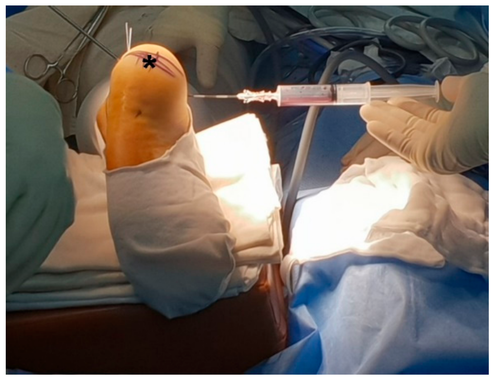 Medicina 57 00111 g004