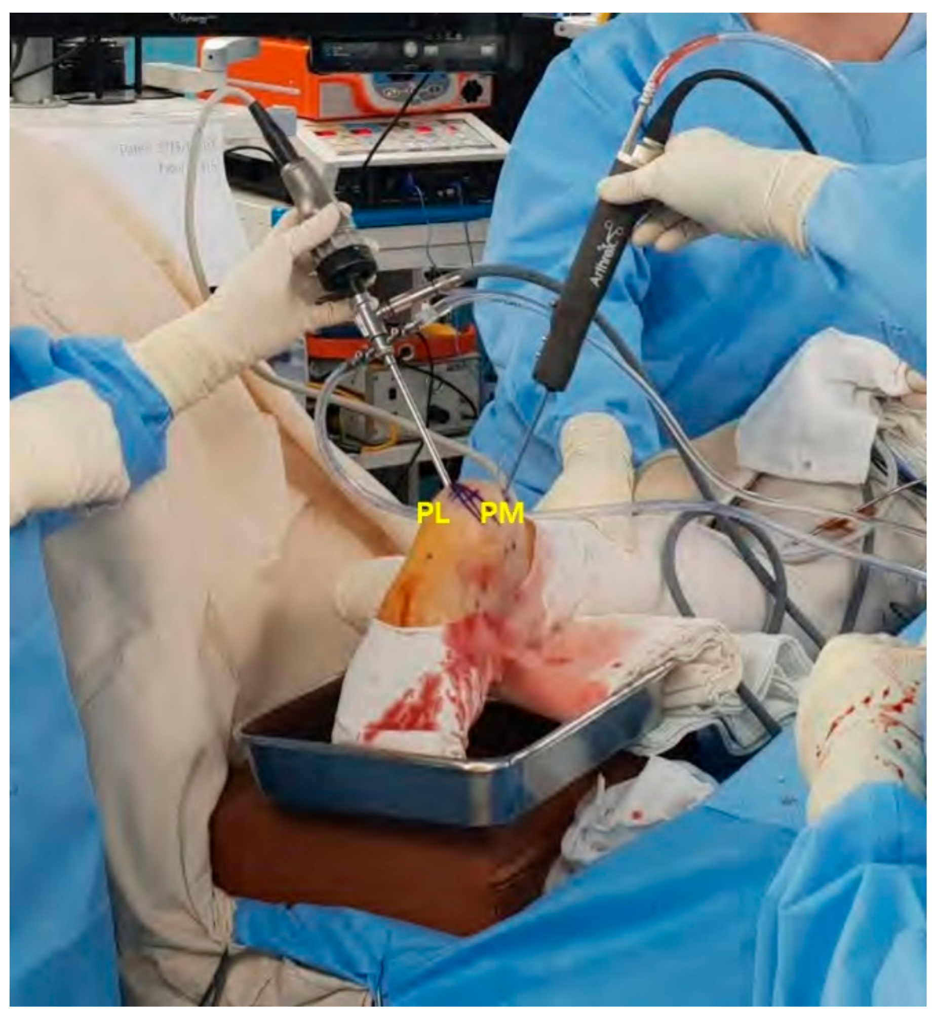 Medicina 57 00111 g006